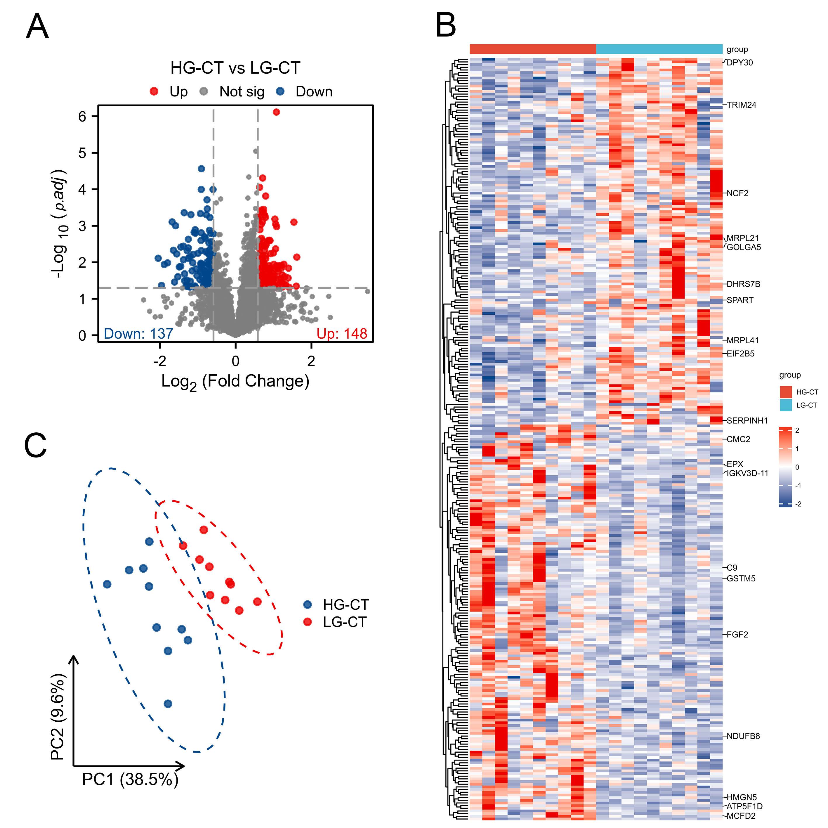 Proteomics analysis of differentially expressed genes (DEGs) in
HG-CT groups compared to LG-CT groups of 20 EC patients. (A) Volcano plot of 285
DEGs, as follows: proteins presenting a fold change of more than 1.5 or less than
0.67 and p < 0.05. (B) Hierarchical clustering of 285 dysregulated
proteins in tumors of different grades, and labeled the Top 10 up/down-regulated
protein names. (C) PCA illustrating moderate clustering of tumor samples within
each group. HG-CT: high-grade cancer tissue; LG-CT: low-grade cancer tissue;
DPY30: Dpy-30 homolog; TRIM24: Tripartite motif containing 24; NCF2: Neutrophil
cytosolic factor 2; MRPL21: Mitochondrial ribosomal protein L21; GOLGA5: Golgin
A5; DHRS7B: Dehydrogenase/reductase (SDR family) member 7B; SPART (SPG20):
Spastic paraplegia 20; MRPL41: Mitochondrial ribosomal protein L41; EIF2B5:
Eukaryotic translation initiation factor 2B, subunit 5; SERPINH: Serpin peptidase
inhibitor, clade H (heat shock protein 47), member 1; CMC2: C-x(9)-C motif
containing 2; EPX: Eosinophil peroxidase; IGKV3D-11: Immunoglobulin kappa
variable 3D-11; C9: Complement component 9; GSTM5: Glutathione S-transferase mu
5; FGF2: Fibroblast growth factor 2; NDUFB8: NADH dehydrogenase (ubiquinone) 1
beta subcomplex, 8; HMGN5: High mobility group nucleosome binding domain 5;
ATP5F1D: ATP synthase, H+ transporting, mitochondrial F1 complex; MCFD2: Multiple
coagulation factor deficiency 2.