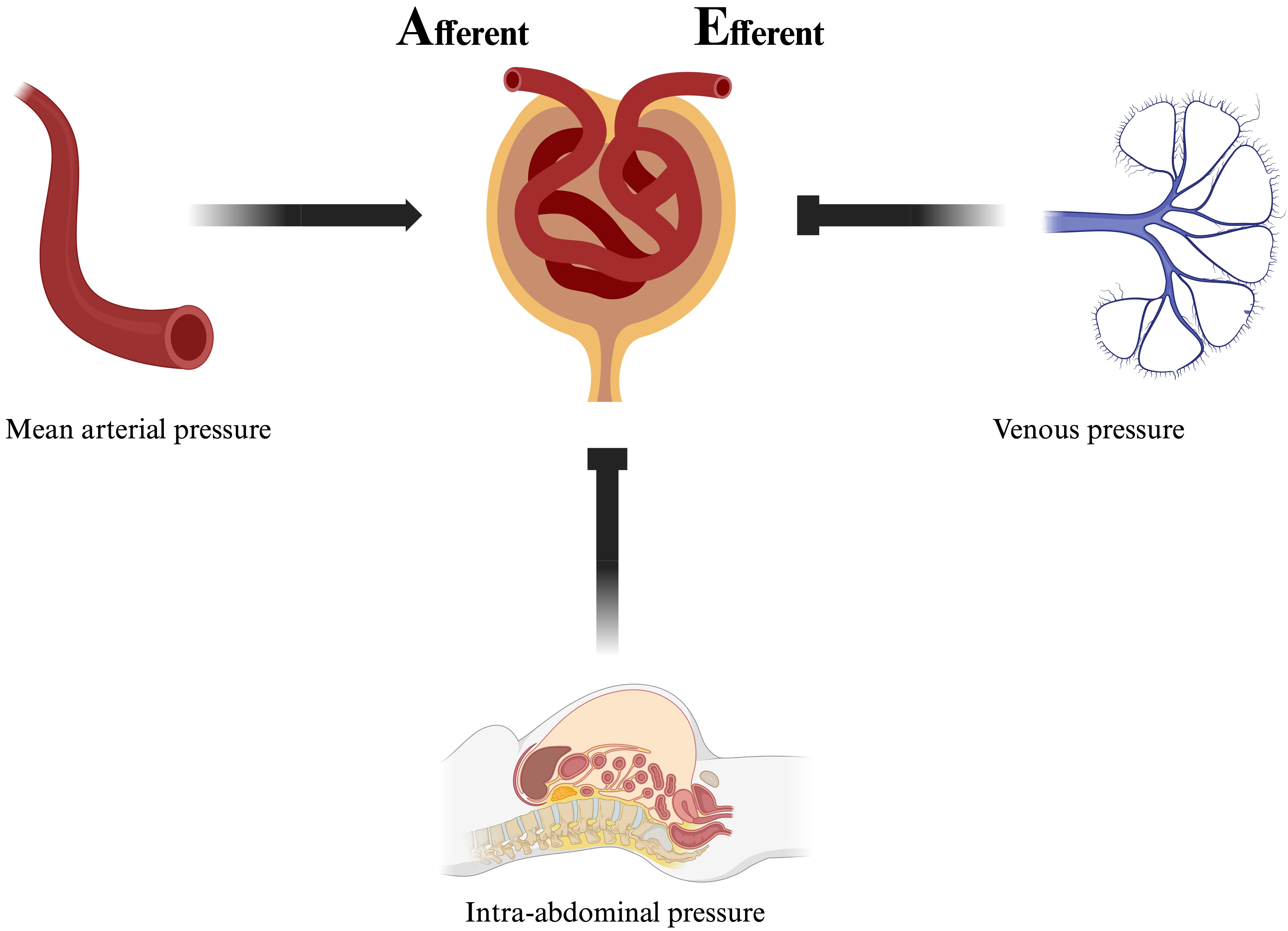 Hemodynamic interactions regulating renal flow. Perfusion pressure is directly derived from mean arterial pressure (MAP), which is opposed by intra-abdominal pressure and venous pressure, exerting opposing forces on incoming flow. This relationship is described by the equation: perfusion pressure = MAP − (intra-abdominal pressure + venous pressure). Pathological conditions such as ascites, which increase intra-abdominal pressure, or right ventricular dysfunction, which raises venous pressure, can decrease perfusion pressure. Flow enters through the afferent arteriole and exits via the efferent arteriole. The mechanisms that maintain constant flow despite a decrease in perfusion pressure include efferent arteriole constriction or afferent arteriole dilation. This ensures a stable flow despite the decrease in pressure. When compensatory mechanisms are maximized, flow decreases as pressure decreases: this marks the lower limit of renal autoregulation.