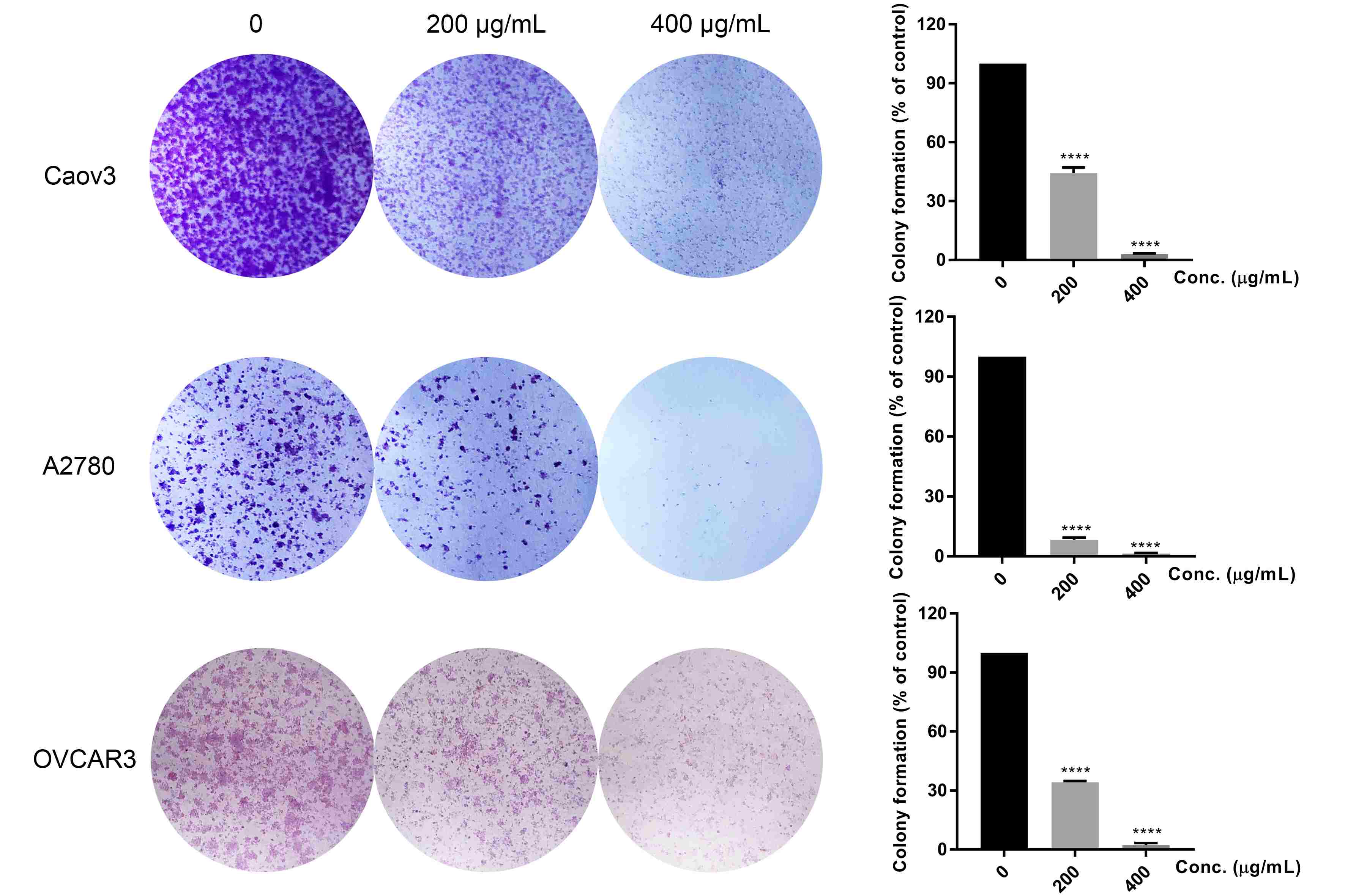 EH inhibits clonogenicity capability of ovarian cancer cells. Caov3, A2780 and OVCAR3 cells were treated with EH extracts of different
concentrations (0, 200 and 400 μg/mL). A colony formation assay was
conducted to validate the effect of EH extracts on cell clonogenicity capability.
Data are represented by the mean ± SD. ****p < 0.0001; Student’s
t-test versus the untreated group.