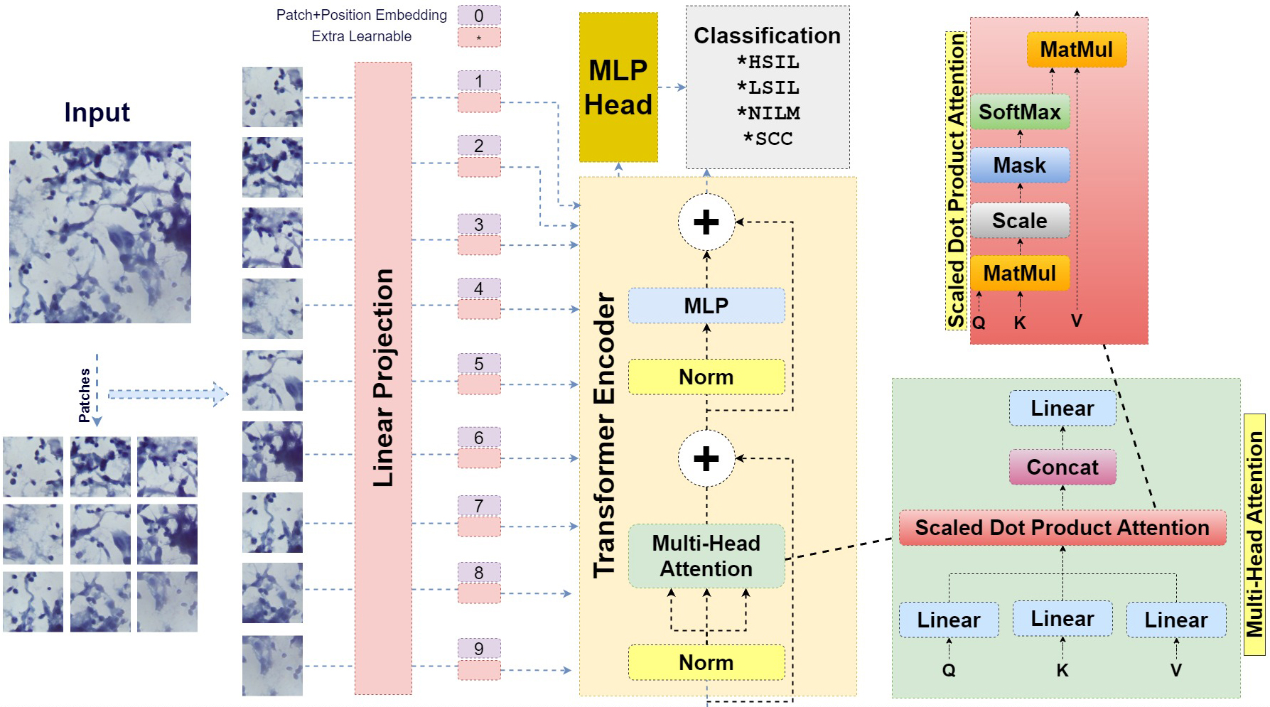 General structure of ViT architecture. HSIL: High-grade Squamous
Intraepithelial Lesion; LSIL: Low-grade Squamous Intraepithelial Lesion; NILM:
Negative for Intraepithelial Lesion or Malignancy; SCC: Squamous Cell Carcinoma;
MLP: Multilayer Perceptron; *: Extra Learnable (Parameter).