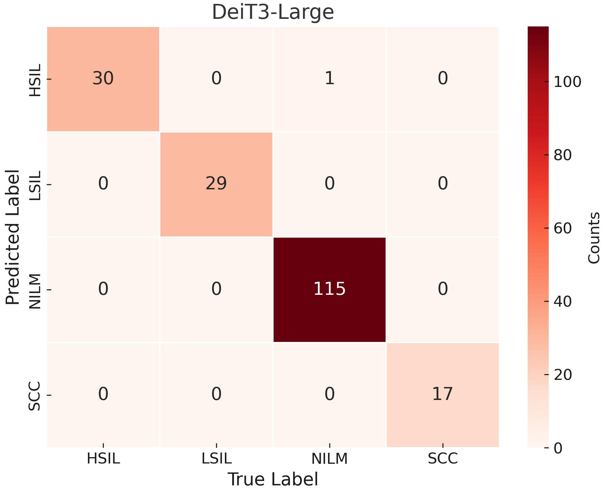 Confusion matrix of DeiT3-Large model. HSIL: High-grade Squamous
Intraepithelial Lesion; LSIL: Low-grade Squamous Intraepithelial Lesion; NILM:
Negative for Intraepithelial Lesion or Malignancy; SCC: Squamous Cell Carcinoma.