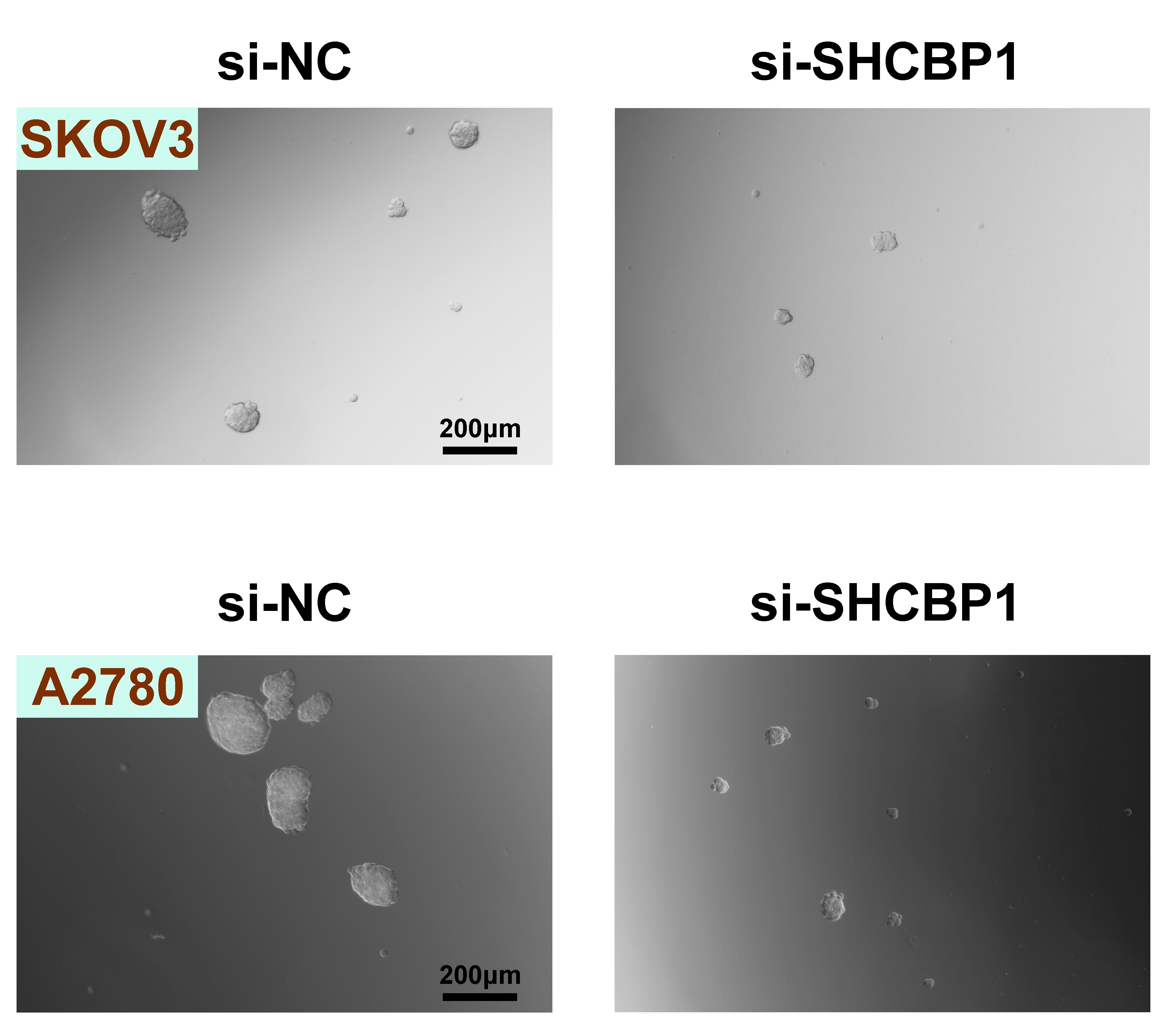 Silencing SHCBP1 repressed OC cells stemness. The stemness of
SKOV3 as well as A2780 cells upon the indicated transfection was assessed by
sphere formation assay. si-NC: small interfering RNA control;
SHCBP1: SHC-adaptor protein (SHC) binding and
spindle-associated protein 1.
