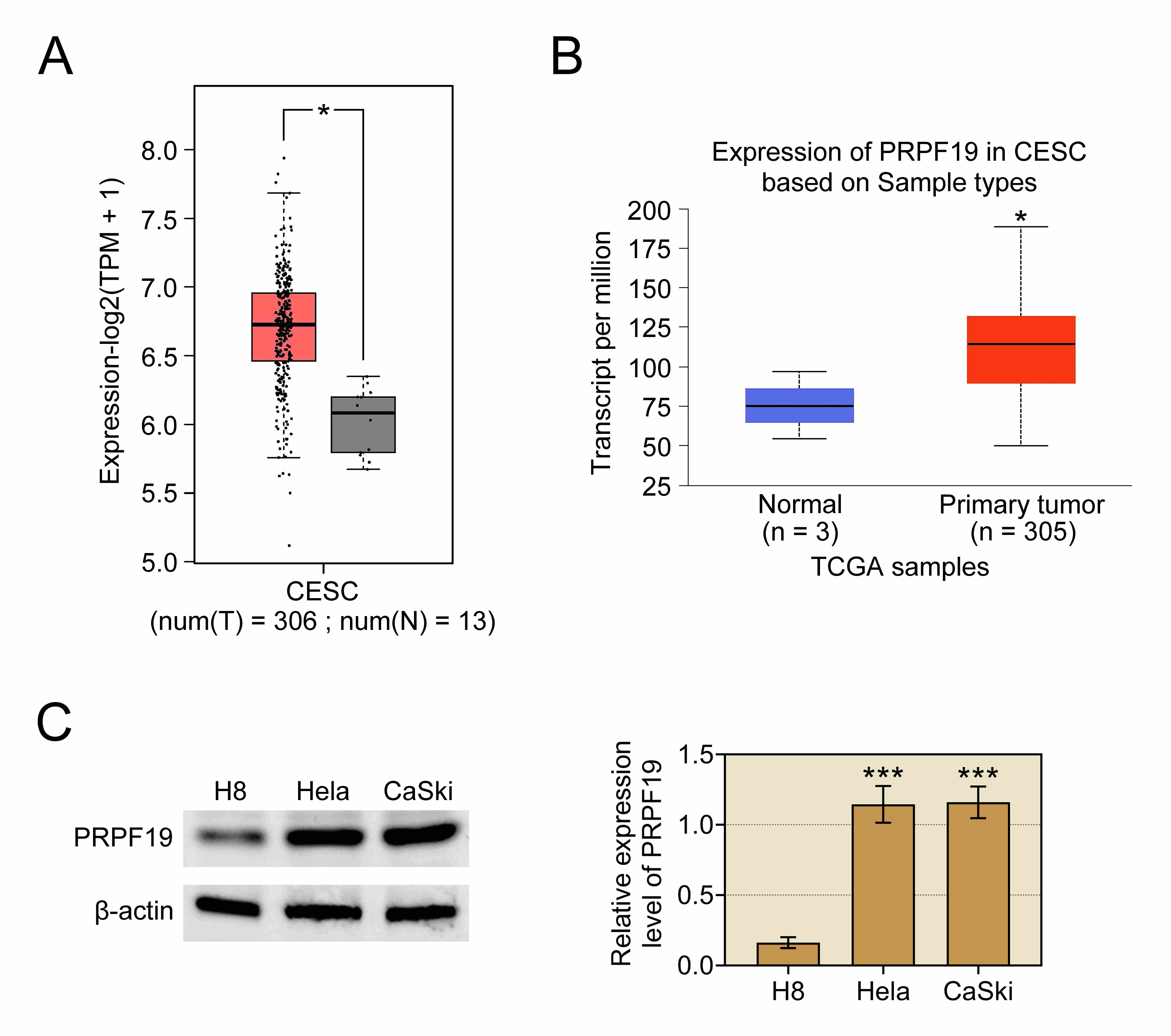 PRPF19 is overexpressed in cervical cancer. (A)
PRPF19 expression was analyzed in
normal tissues and cervical squamous cell carcinoma (CESC) tissues using the
GEPIA online database. (B) PRPF19 expression was further validated in
normal and CESC tissues using the UALCAN online database. (C) PRPF19 protein
levels were assessed in the human cervical epithelial immortalized cell line (H8)
and cervical cancer cell lines (HeLa and CaSki) by western blot analysis.
*p < 0.05, ***p < 0.001. PRPF19:
Pre-mRNA-processing factor 19; TPM:
Transcripts Per Million; TCGA: The Cancer
Genome Atlas.