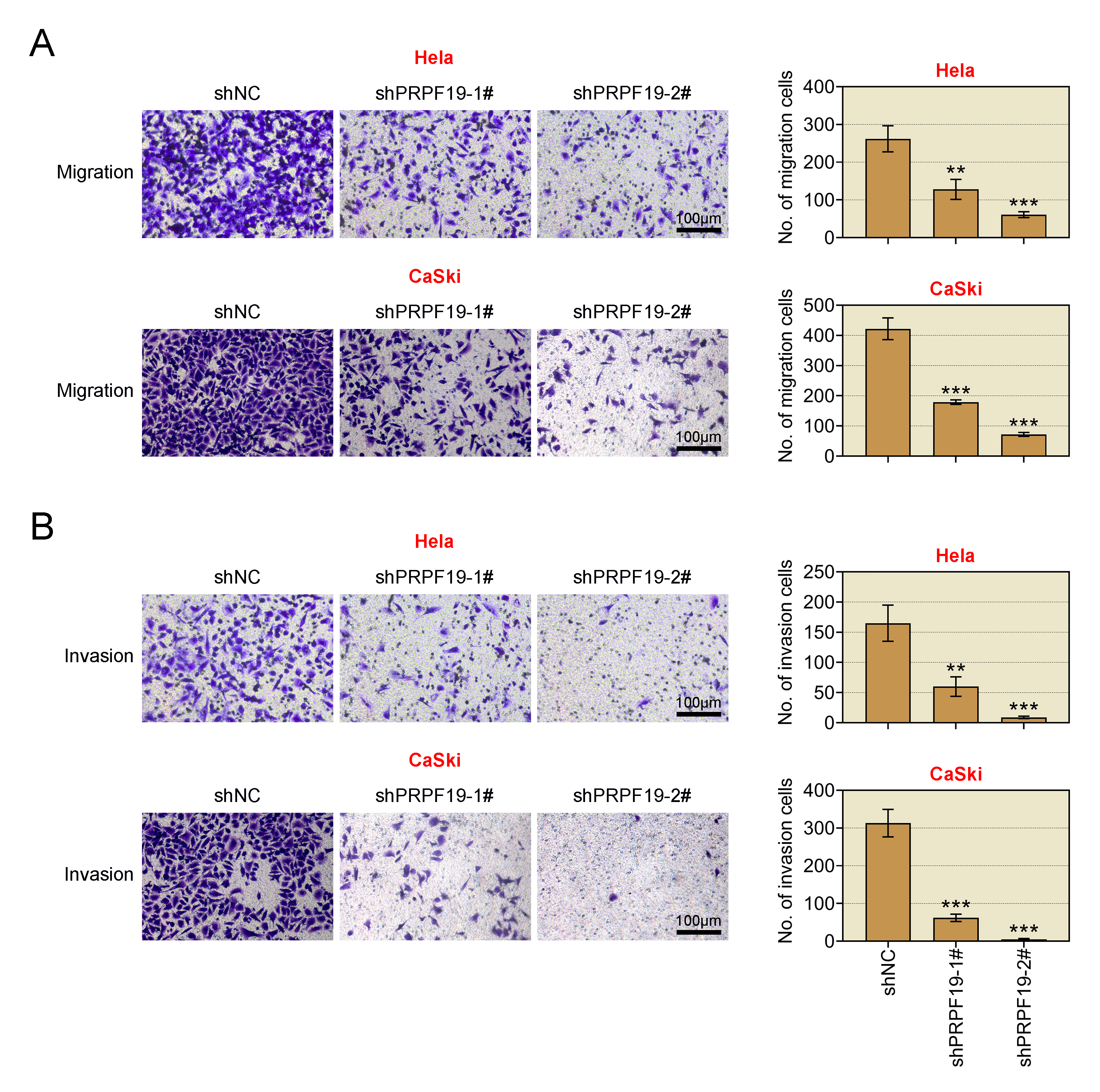 PRPF19 suppression inhibits cell migration and invasion. The
groups assessed included shNC, shPRPF19-1#, and shPRPF19-2#. (A) Cell migration
was assessed in HeLa and CaSki cells using a Transwell assay. (B) Cell invasion
was evaluated in HeLa and CaSki cells using a Transwell assay.
**p < 0.01,
***p < 0.001. PRPF19: Pre-mRNA-processing factor 19;
shNC: Short hairpin negative control.