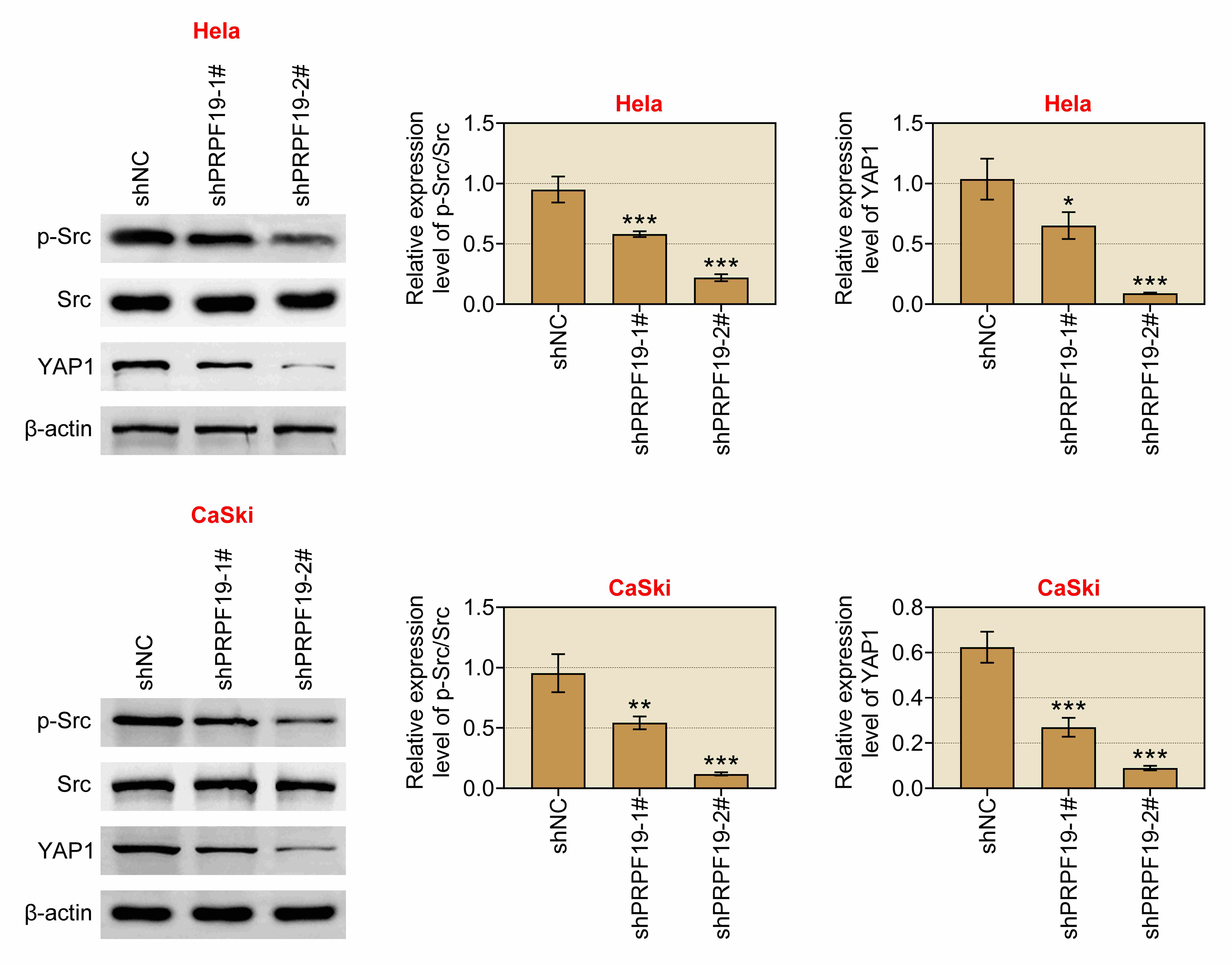 PRPF19 activates the Src-YAP1 pathway. HeLa and CaSki
cells were divided into the shNC, shPRPF19-1#, and shPRPF19-2# groups and the
protein expression levels of p-Src, Src and YAP1 were detected via western blot.
*p < 0.05, **p < 0.01,
***p < 0.001. PRPF19: Pre-mRNA-processing factor 19;
shNC: Short hairpin negative control; Src: Sarcoma; YAP1: Yes-associated protein
1.
