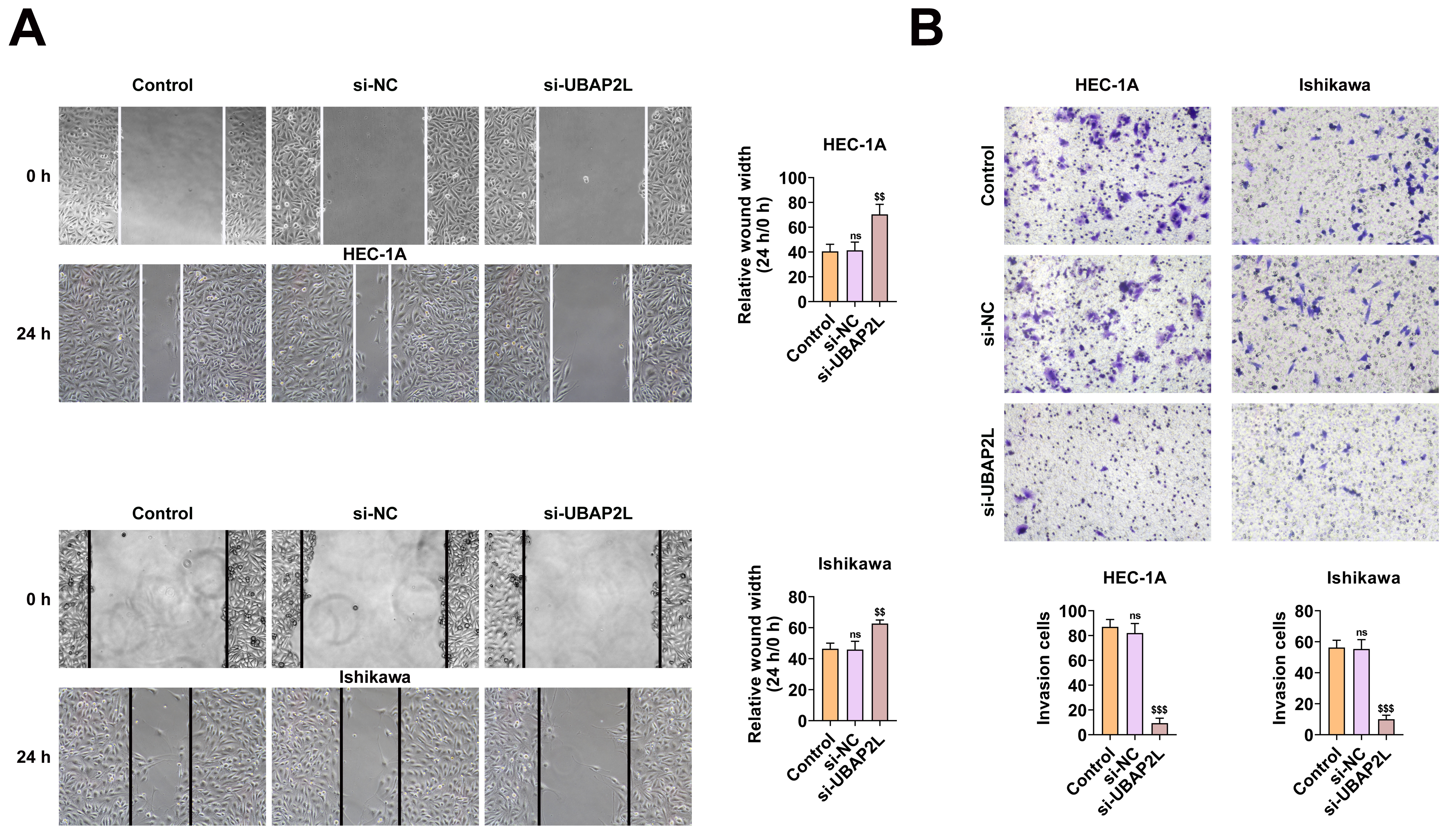 Knockdown of UBAP2L suppresses migration and invasion of 
endometrial cancer cells. (A) Wound healing assay showing the migration ability 
of HEC-1A and Ishikawa cells after treatment with control, si-NC or si-UBAP2L at 
0 h and 24 h. Quantification of relative wound width is shown on the right. (B) 
Transwell invasion assay displaying the number of invasive cells in HEC-1A and 
Ishikawa cells treated with control, si-NC or si-UBAP2L. Quantification of 
invasive cells is shown below. ns: not significant. $$p < 0.01, 
$$$p < 0.001. NC: negative control; UBAP2L: 
Ubiquitin-associated protein 2L; HEC-1A: human endometrial cancer-1A.