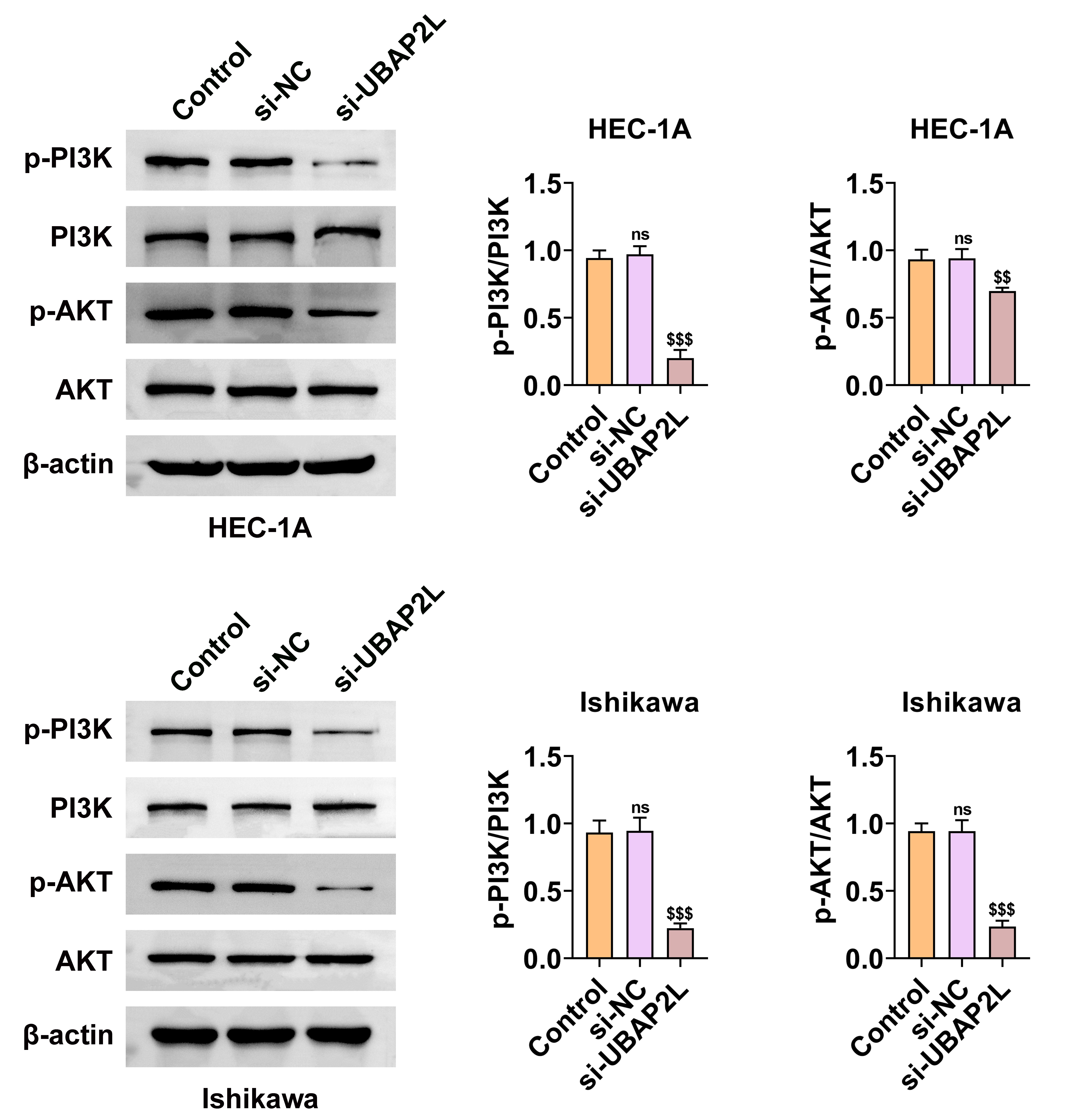 UBAP2L knockdown inhibits the PI3K/AKT signaling pathway in 
endometrial cancer cells. Immunoblot analysis of p-PI3K, PI3K, p-AKT and AKT 
protein levels in HEC-1A (up) and Ishikawa (down) cells after treatment with 
control, si-NC or si-UBAP2L. β-actin is used as a loading control. 
Quantification of the p-PI3K/PI3K and p-AKT/AKT ratios is shown on the right for 
both cell lines. ns: not significant; $$p < 0.01, 
$$$p < 0.001. NC: negative control; PI3K: phosphatidylinositol 
3 kinase; AKT: protein kinase B; UBAP2L: Ubiquitin-associated protein 2L; HEC-1A: 
human endometrial cancer-1A.