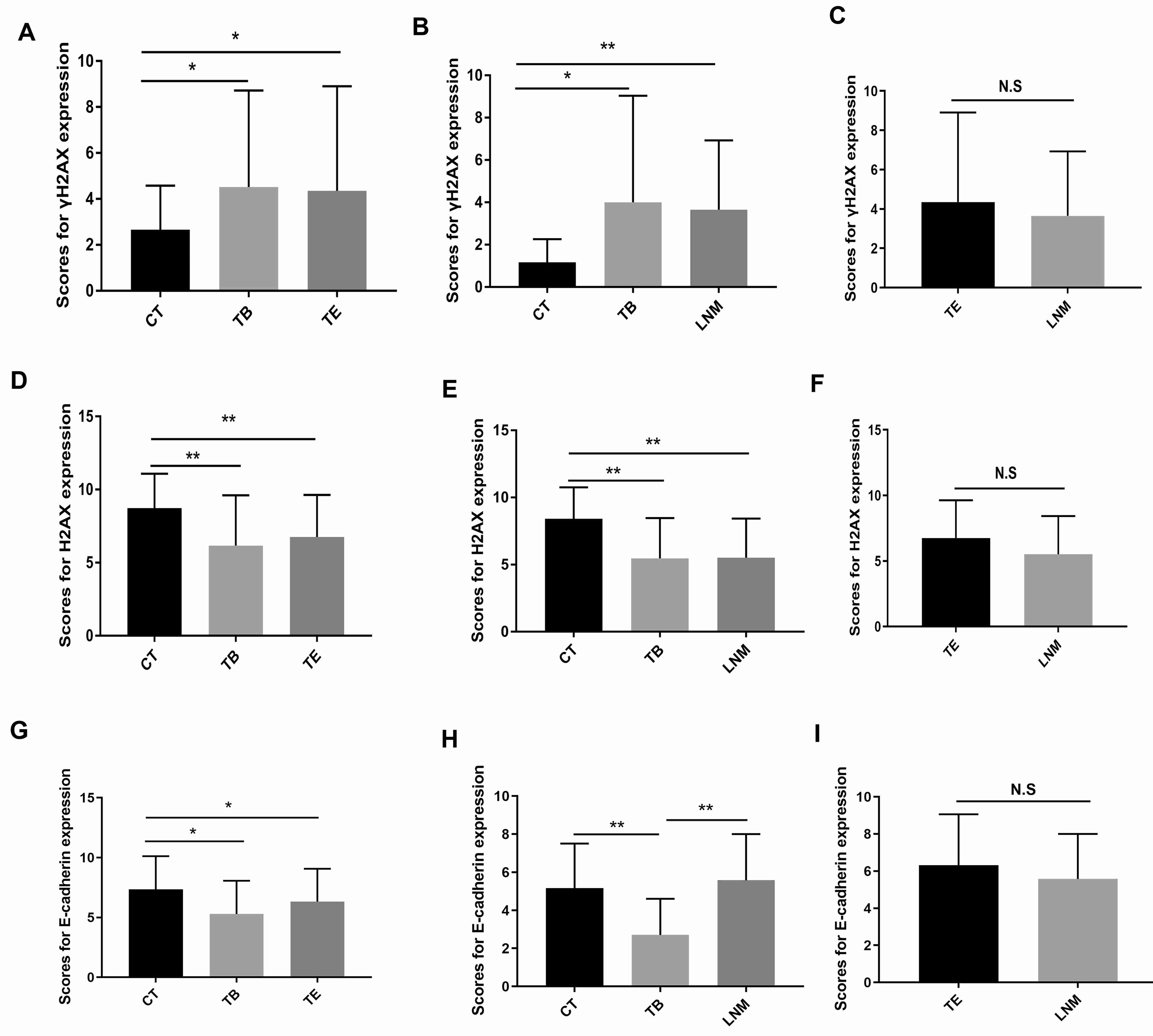 Changes of γH2AX, H2AX and E-cadherin expression in
central tumors, tumor budding, tumor emboli and metastatic lymph nodes.
Comparison of γH2AX (A), H2AX (D) and E-cadherin (G) expression in
central tumors, tumor budding, and tumor emboli in the same patients (N = 18).
Comparison between the expression levels of γH2AX (B), H2AX (E), and
E-cadherin (H) in central tumors, tumor budding and metastatic lymph nodes in the
same patients (N = 16). Comparison between the expression levels of
γH2AX (C), H2AX (F), and E-cadherin (I) in tumor emboli and metastatic
lymph nodes (N = 18 and N = 16, respectively). CT: central tumors; TB: tumor
budding; TE: tumor emboli; LNM: Metastatic lymph nodes. *, p < 0.05;
**, p < 0.01.