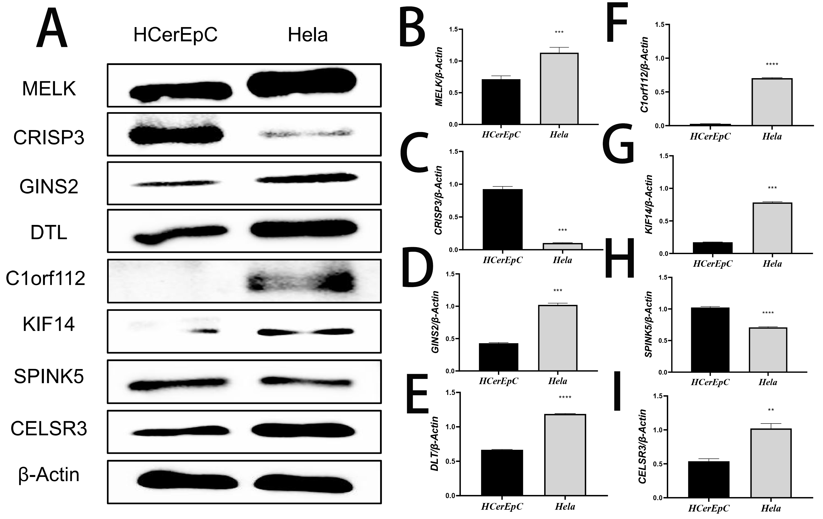 The expression of eight disease-specific
proteins in human cervical epithelial cell line HCerEpC and human cervical cancer
cell line Hela was detected by WB. (A) The total. (B) MELK. (C) CRISP3. (D)
GINS2. (E) DTL. (F) C1orf112. (G) KIF14. (H) SPINK5. (I) CELSR3. **: p < 0.01; ***: p < 0.001; ****: p
< 0.0001.
