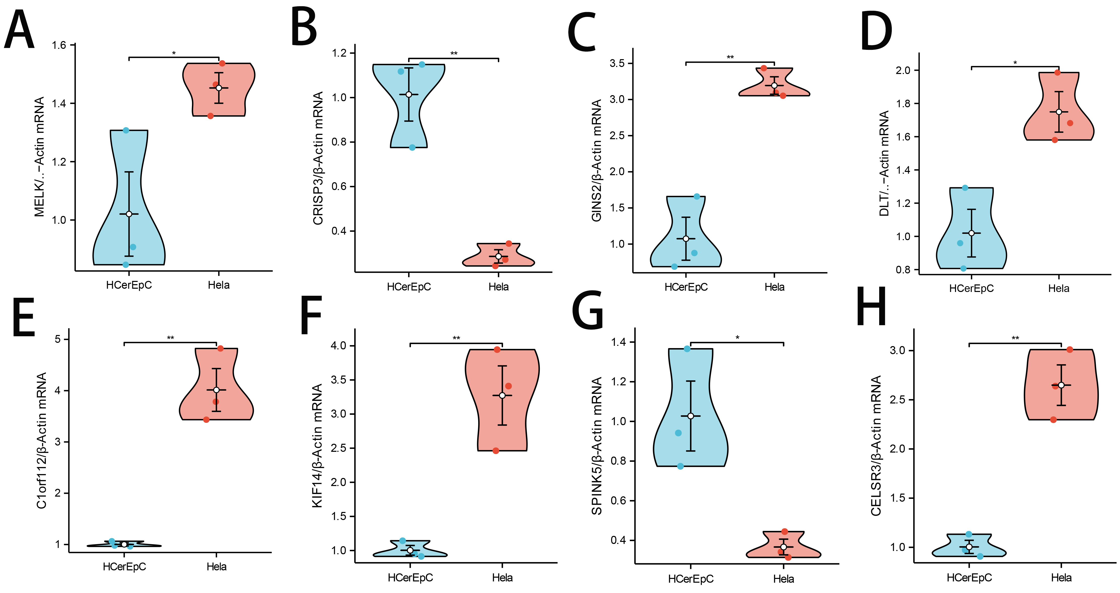 The expression of 8 disease
characteristic genes in human cervical epithelial cells HCerEpC and human
cervical cancer cells Hela was detected by RT-qPCR. (A)
MELK. (B) CRISP3. (C) GINS2. (D) DTL. (E)
C1orf112. (F) KIF14. (G) SPINK5. (H) CELSR3.
*: p < 0.05; **: p < 0.01.