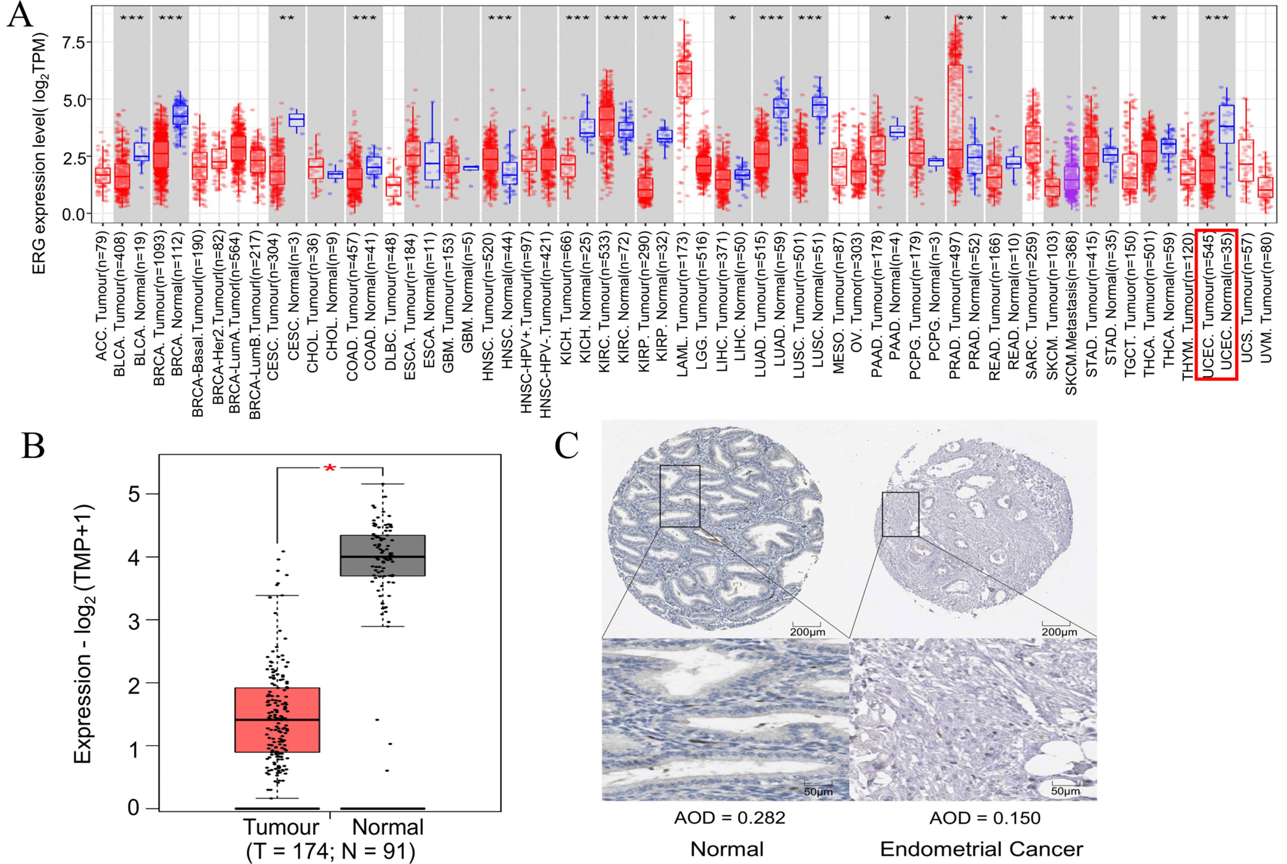 ERG expression in various cancers and endometrial
carcinoma (EC). (A) ERG expression in various carcinomas determined
using The Cancer Genome Atlas data and TIMER2.0. (B) ERG expression in
EC determined using GEPIA. Tumour and normal tissue are indicated by red and
grey, respectively. (C) Immunohistochemical staining results, retrieved from the
Human Protein Atlas, for erythroblast transformation-specific-related gene
(ERG) protein expression in EC and normal adjacent tissues. The
rectangles are zoomed in portions of normal and endometrial cancer tissue.
*p < 0.05, **p < 0.01, ***p < 0.001. AOD:
average optical density.
