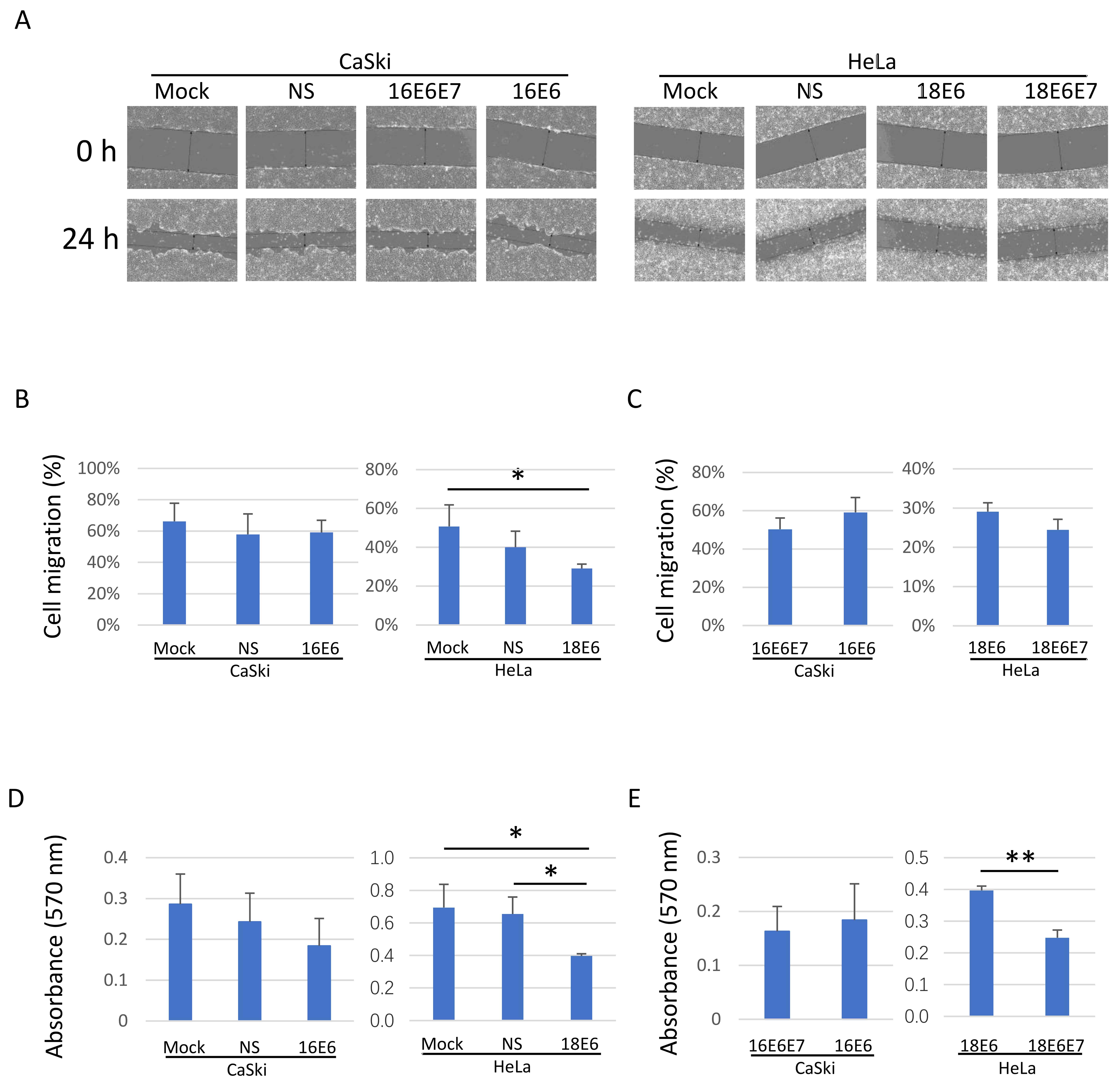 Analyses of migration and transformation in CaSki and HeLa cells
transfected with mock, NS, 16E6E7, 16E6, 18E6 or 18E6E7 small interfering RNAs
(Table 1). (A) Representative images of the wound healing assay (magnification,
×10). (B) Percentages of cell migration following knockdown of E6 based
on the wound healing assay. (C) Percentages of cell migration following knockdown
of E7 based on the wound healing assay. (D) Anchorage-independent growth
(absorbance at 570 nm) following knockdown of E6 based on the transformation
assay. (E) Anchorage-independent growth following knockdown of E7 based on the
transformation assay. Data are presented as the mean ± SD. Differences were
compared by one-way ANOVA with Tukey’s post-hoc test or unpaired
Student’s t-test. *p < 0.05, **p < 0.01. NS:
Non-specific.