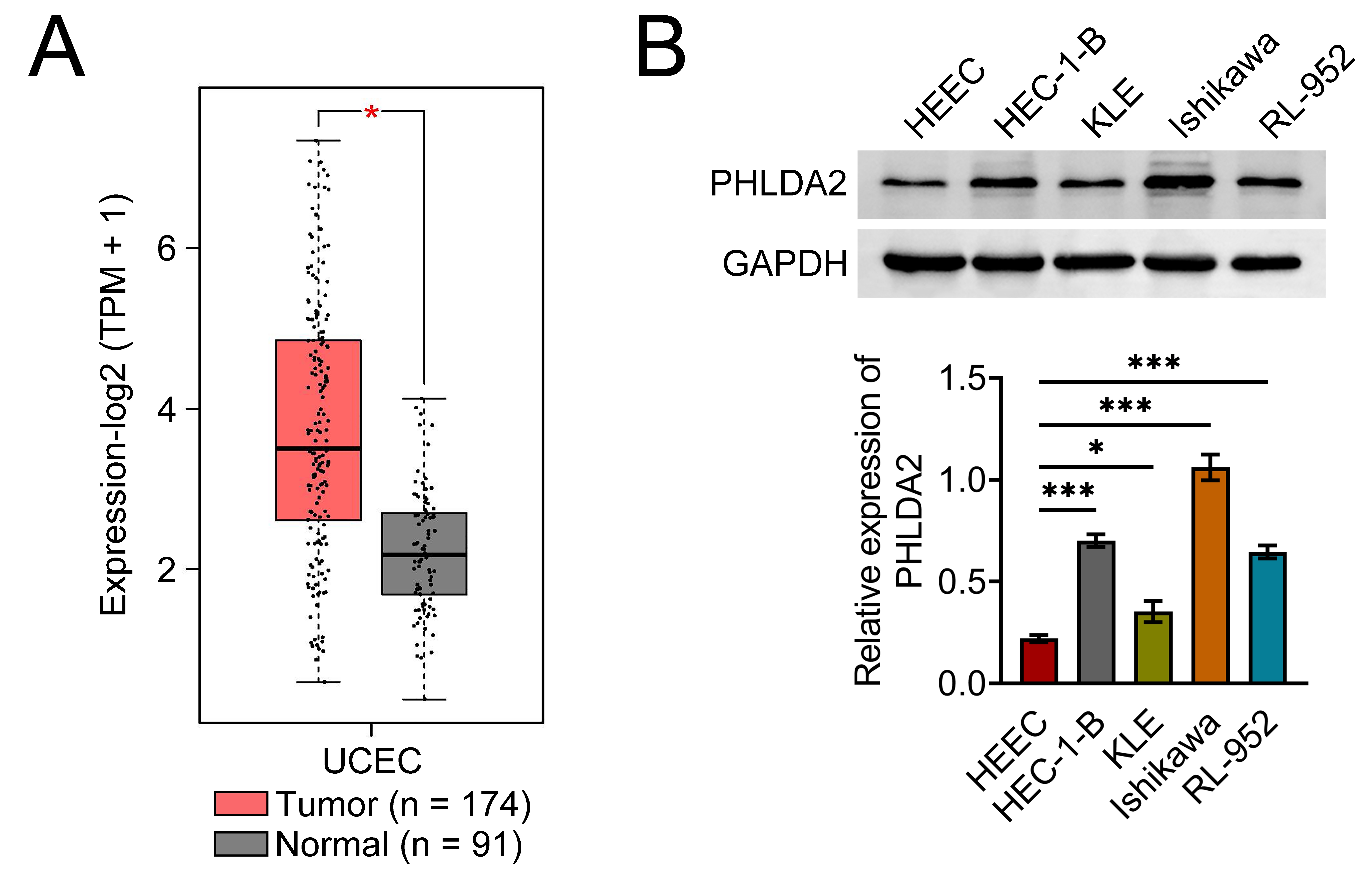 PHLDA2 is highly expressed in endometrial cancer (EC). (A)
PHLDA2 expression levels in Uterine Corpus Endometrial Carcinoma (UCEC) tumor
tissues were analyzed using The Cancer Genome Atlas (TCGA) database. (B) Western
blot analysis of PHLDA2 protein expression in EC cell lines compared to normal
human endometrial epithelial cells (HEECs).
*p < 0.05, *p
< 0.05, ***p < 0.001. PHLDA2: Pleckstrin homology-like domain
family A member 2; TPM: Transcripts Per Million; GAPDH:
Glyceraldehyde-3-Phosphate Dehydrogenase.