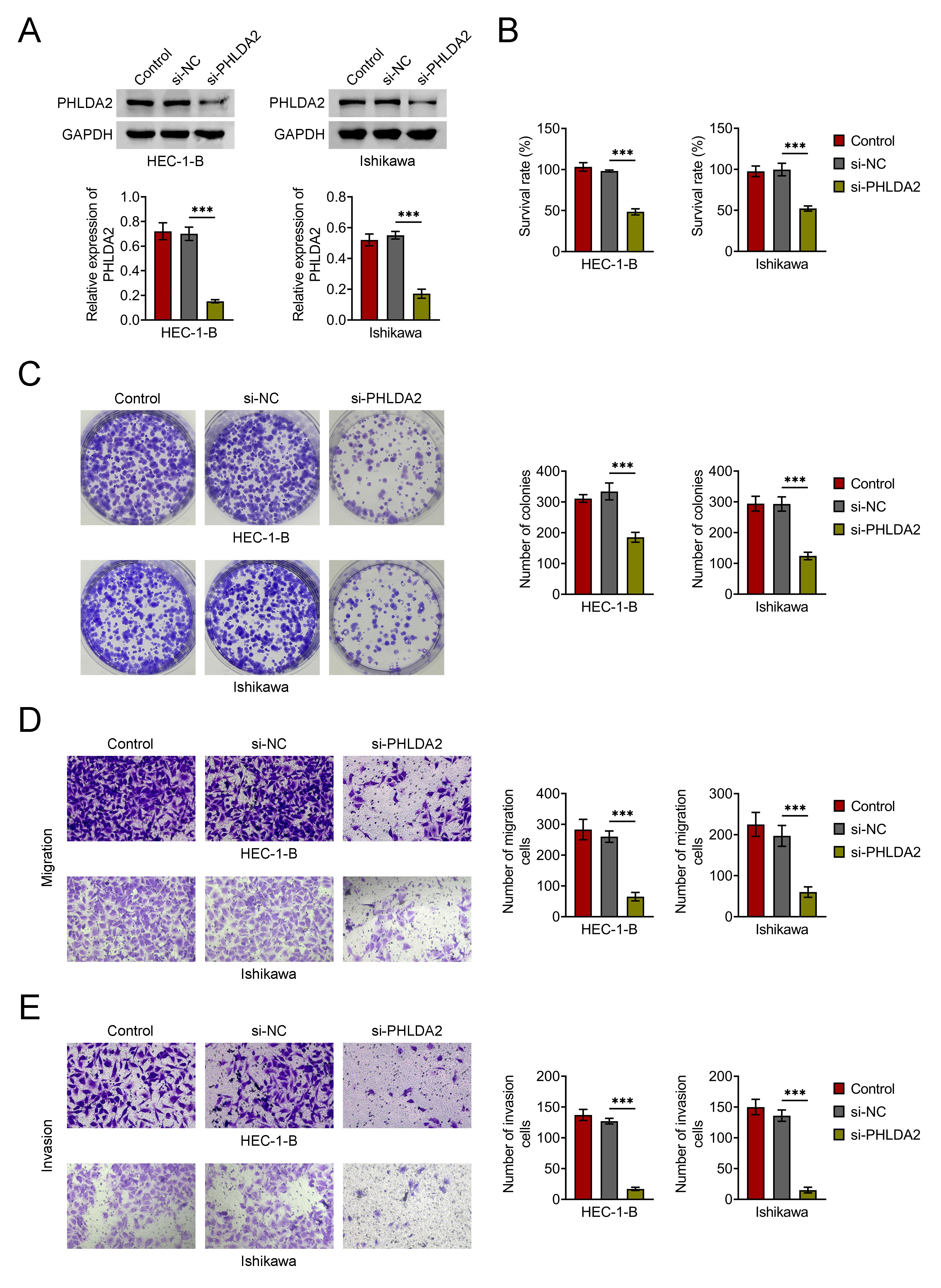 Knockdown of PHLDA2 suppresses EC cell proliferation, migration
and invasion. (A) Western blot analysis confirming PHLDA2 knockdown in EC cells
transfected with si-PHLDA2. (B) Cell viability was assessed using the CCK-8
assay. (C) Clonogenic potential was evaluated using the colony formation assay.
(D,E) Transwell assays were performed to assess cell migration and invasion.
***p < 0.001. PHLDA2: Pleckstrin homology-like domain family A member
2; si-NC: small interfering RNA negative control; si-PHLDA2: small interfering
RNA targeting PHLDA2; GAPDH: Glyceraldehyde-3-Phosphate Dehydrogenase.