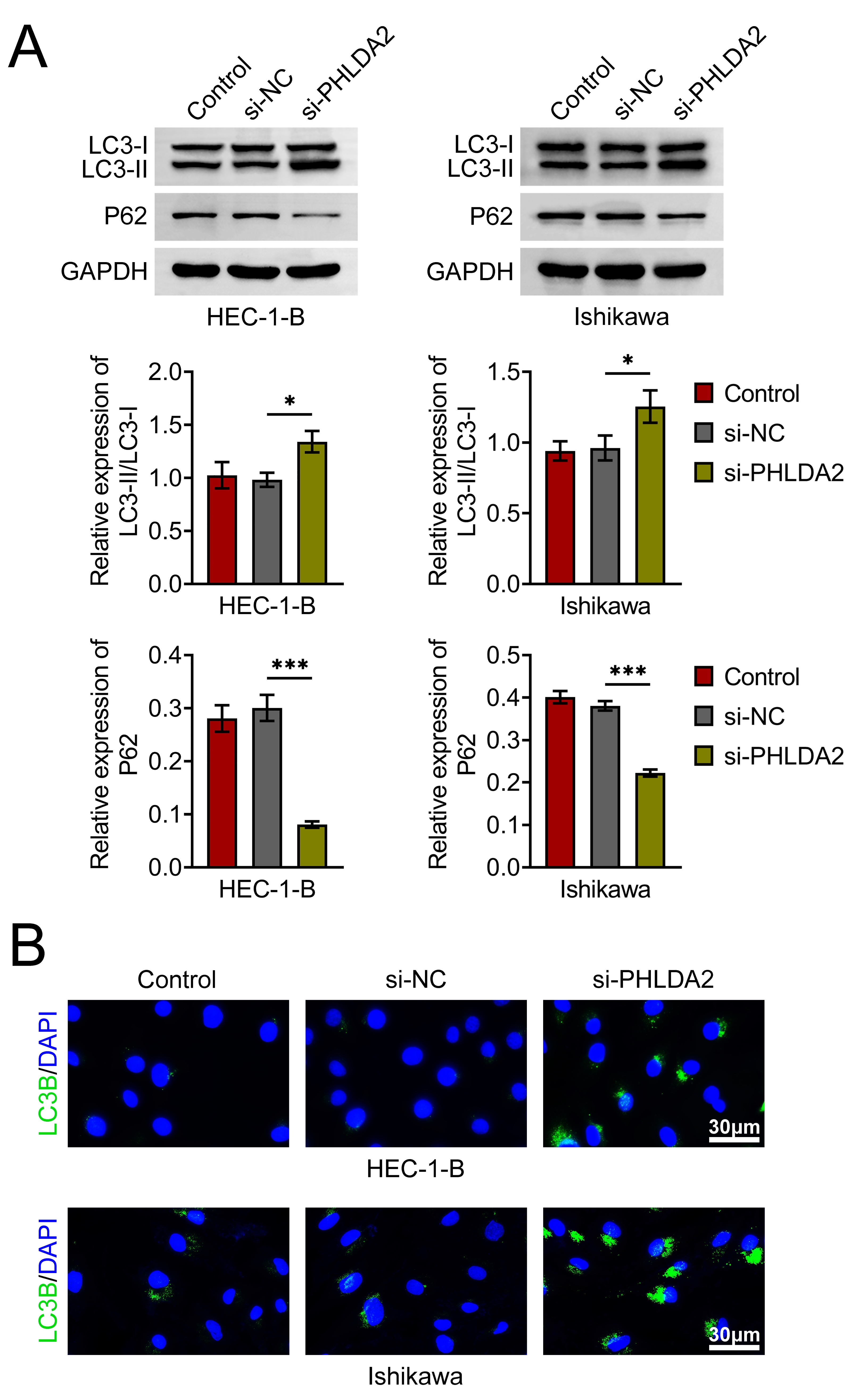 PHLDA2 knockdown induces autophagy in EC cells. (A) Western
blot analysis of autophagy-related proteins LC3-I, LC3-II and P62 following
PHLDA2 knockdown. (B) Immunofluorescence (IF) staining of LC3B expression in EC
cells with PHLDA2 knockdown. *p < 0.05, ***p < 0.001.
si-NC: small interfering RNA negative control; si-PHLDA2: small interfering RNA
targeting PHLDA2; LC3: Microtubule-associated protein 1 light chain 3; GAPHD:
Glyceraldehyde-3-Phosphate Dehydrogenase. LC3B: Microtubule-associated protein 1
light chain 3 beta; DAPI: 4′,6-Diamidino-2-Phenylindole.