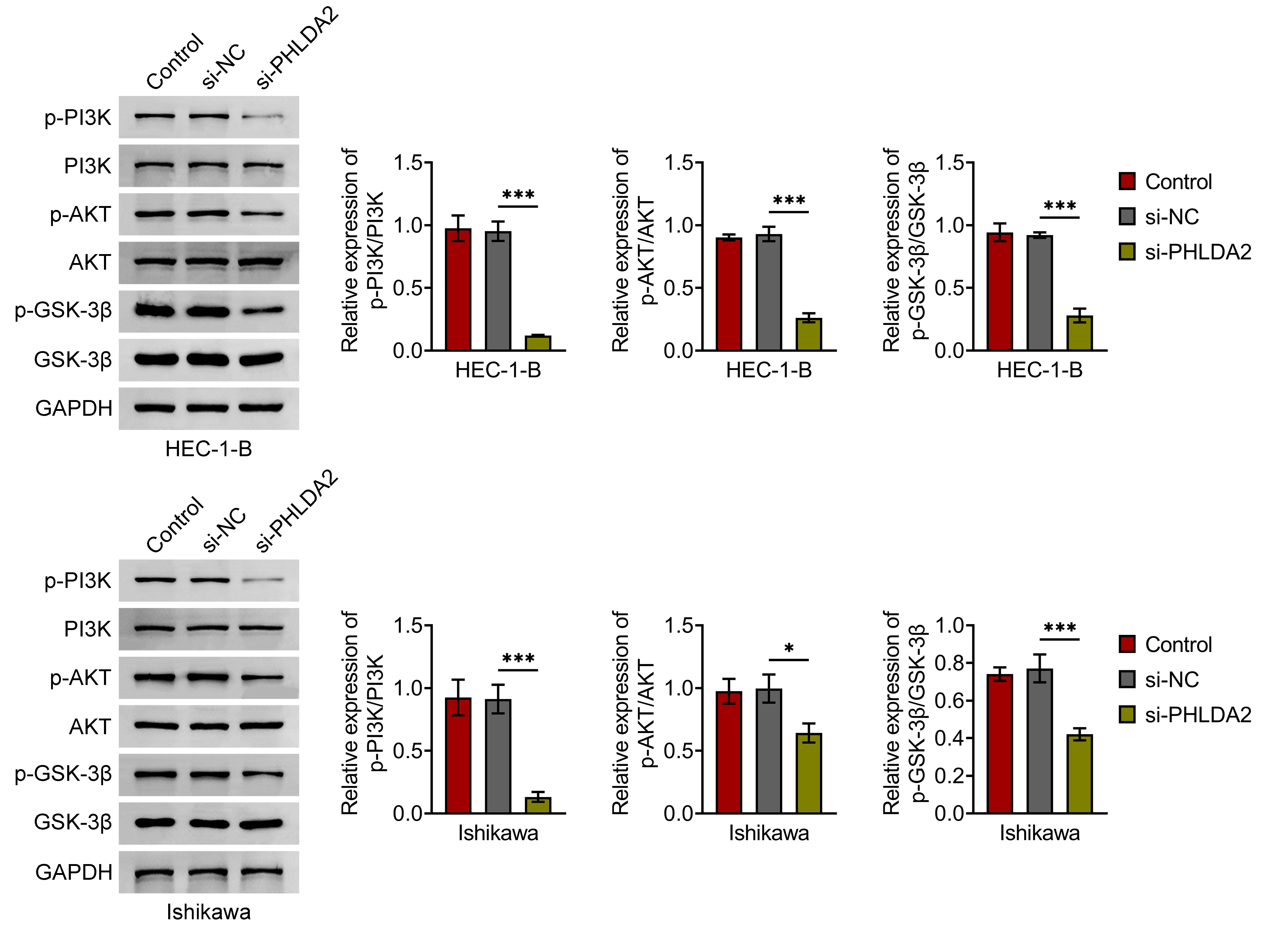 PHLDA2 knockdown inactivates the PI3K/AKT/GSK-3β
pathway. Western blot analysis of phosphorylated and total PI3K, AKT and
GSK-3β protein levels in EC cells following PHLDA2 knockdown. *p
< 0.05, ***p < 0.001. si-NC: small interfering RNA negative
control; si-PHLDA2: small interfering RNA targeting PHLDA2; p-PI3K:
phosphorylated phosphatidylinositol 3-kinase; p-AKT: phosphorylated protein
kinase B; p-GSK-3β: phosphorylated glycogen synthase kinase-3β;
GAPDH: Glyceraldehyde-3-Phosphate Dehydrogenase.