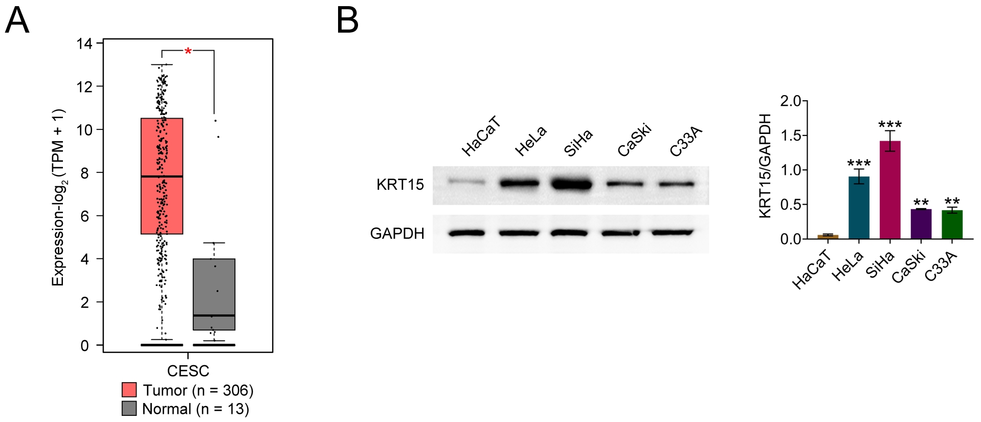 KRT15 expression in cervical cancer. (A) GEPIA database
analysis of KRT15 expression in healthy subjects and cervical cancer patients.
(B) Western blot analysis of KRT15 expression in the Human immortalized
keratinocyte cell line HaCaT and human cervical cancer cell lines HeLa, SiHa,
CaSki and C33A. Values are presented as mean ± SD. *p <
0.05, **p < 0.01, ***p < 0.001. n = 3.
TPM: Transcripts Per Million;
CESC: Cervical squamous cell carcinoma and
endocervical adenocarcinoma; KRT15: Keratin 15; GAPDH: glyceraldehyde-3-phosphate
dehydrogenase.