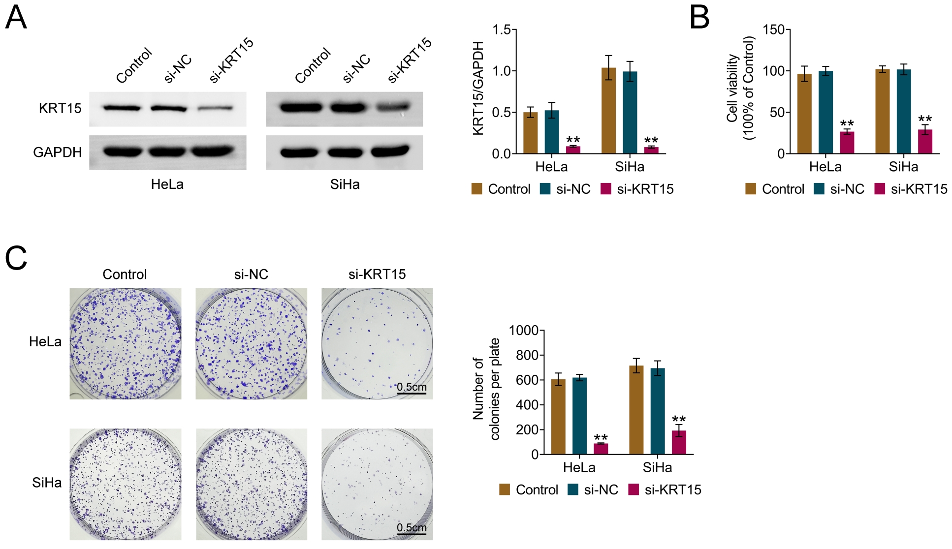 The role of KRT15 in cervical cancer cell proliferation. (A)
KRT15 expression in transfected and untransfected cells. (B) CCK-8 kit detects
cell viability. n = 6. (C) Crystal violet staining detects cell colony formation
ability. Values are presented as mean ± SD. **p < 0.01.
n = 3. KRT15: Keratin 15; GAPDH: glyceraldehyde-3-phosphate dehydrogenase; si-NC:
siRNA Control.