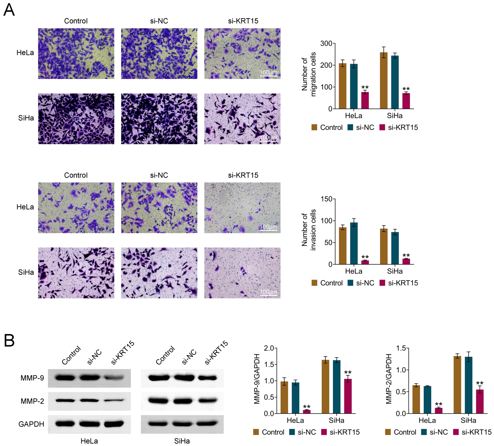 The role of KRT15 in the cervical cancer cell migration and
invasion. (A) Cell migration and invasion numbers. (B) Western blot analysis of
MMP-2 and MMP-9 expression in cells. Values are presented as mean ± SD.
**p < 0.01. n = 3. si-NC: siRNA Control; KRT15: Keratin 15;
GAPDH: glyceraldehyde-3-phosphate dehydrogenase; MMP: matrix metalloproteinase.