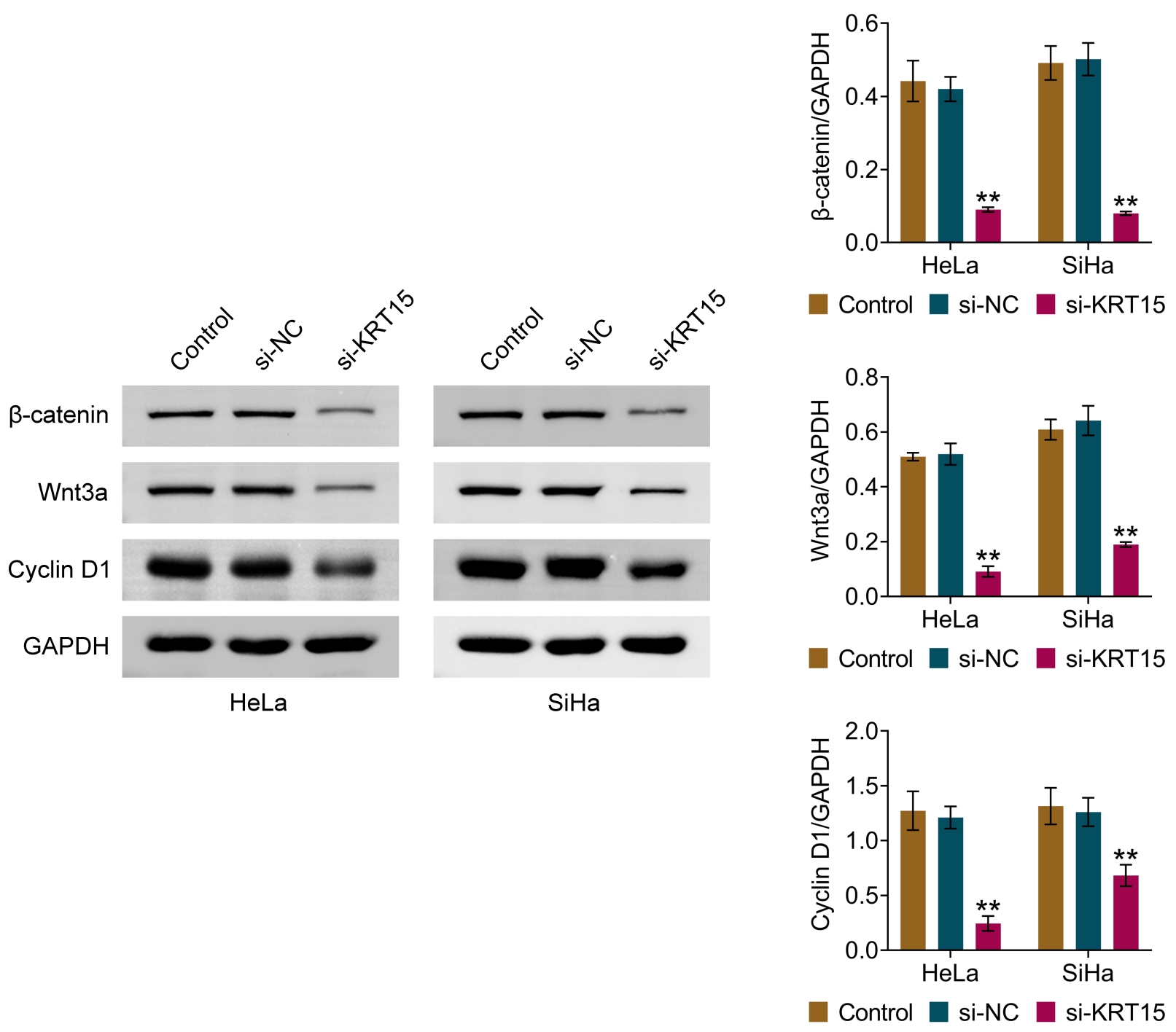 Effect of KRT15 on Wnt/β-catenin pathway in cervical
cancer cells. Western blot analysis of β-catenin, Wnt3a, Cyclin D1
expression in cells. Values are presented as mean ± SD.
**p < 0.01. n = 3. si-NC: siRNA Control; KRT15: Keratin 15;
GAPDH: glyceraldehyde-3-phosphate dehydrogenase.