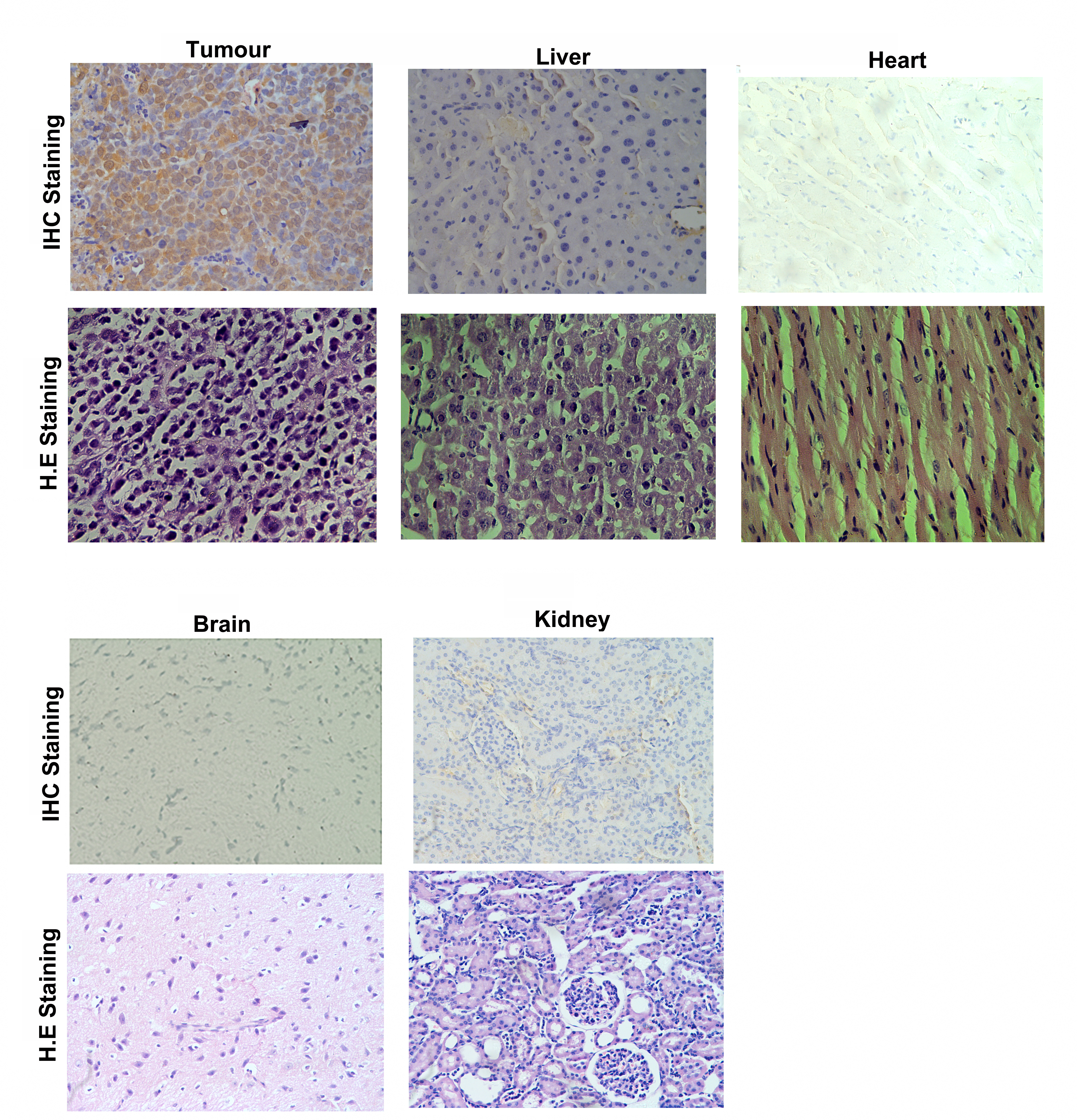 Immunohistochemical phage staining after three rounds of
in vivo screening (magnification 200×). Phages were widely
distributed among tumor cells, while minimal immunoreactivity was observed in
control organs (liver, kidney, brain and heart).