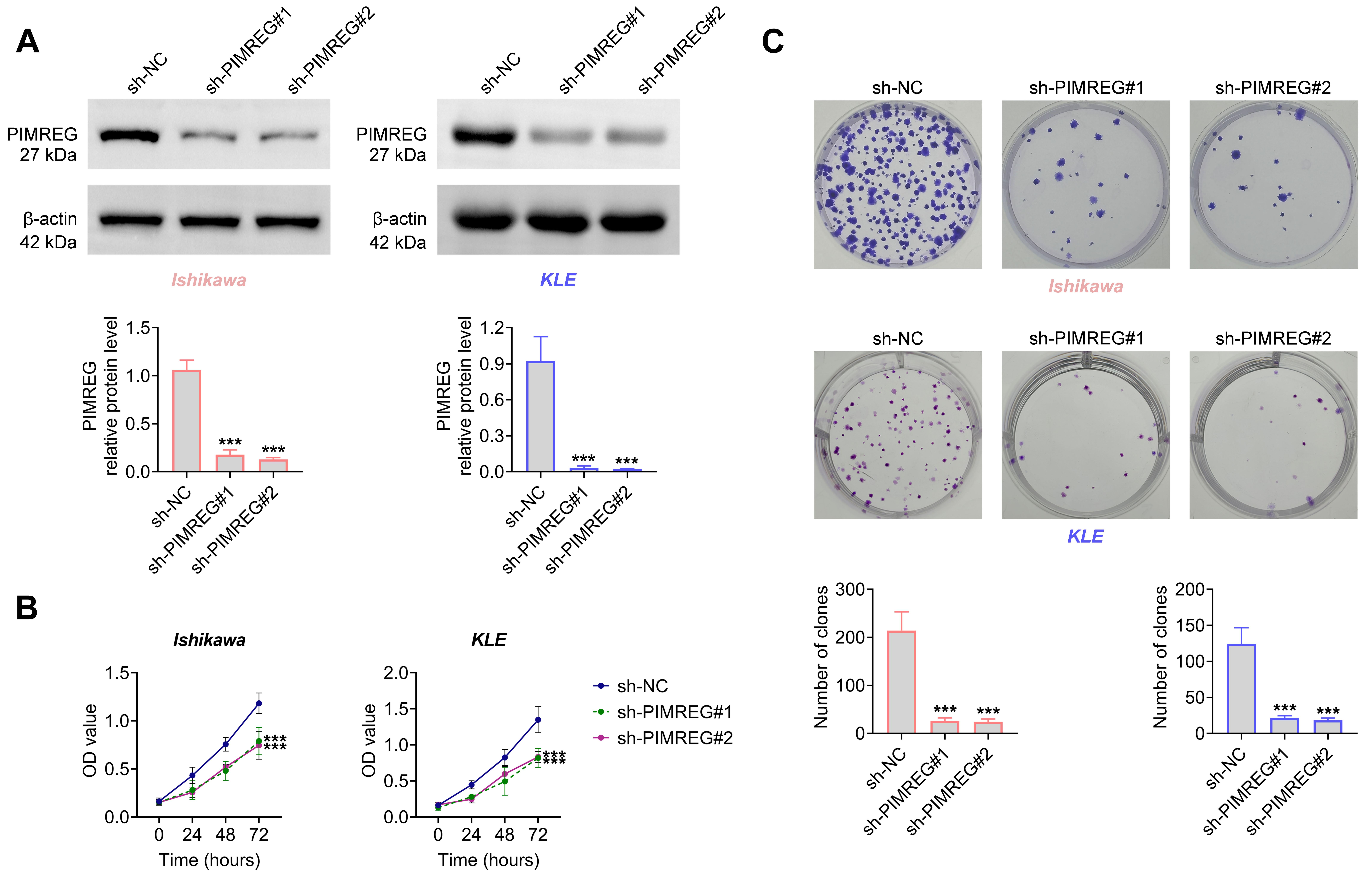 Suppression of PIMREG inhibited cell viability in 
endometrial cancer. Groups were separated into the sh-NC, sh-PIMREG#1 and 
sh-PIMREG#2 groups. (A) The protein expression of PIMREG was tested through 
western blot. (B) The cell viability was examined through the CCK-8 assay. (C) 
The cell proliferation was determined through colony formation assay. 
***p < 0.001. PIMREG: PICALM interacting mitotic regulator; 
sh-NC: Short hairpin-negative control; OD: 
optical density.