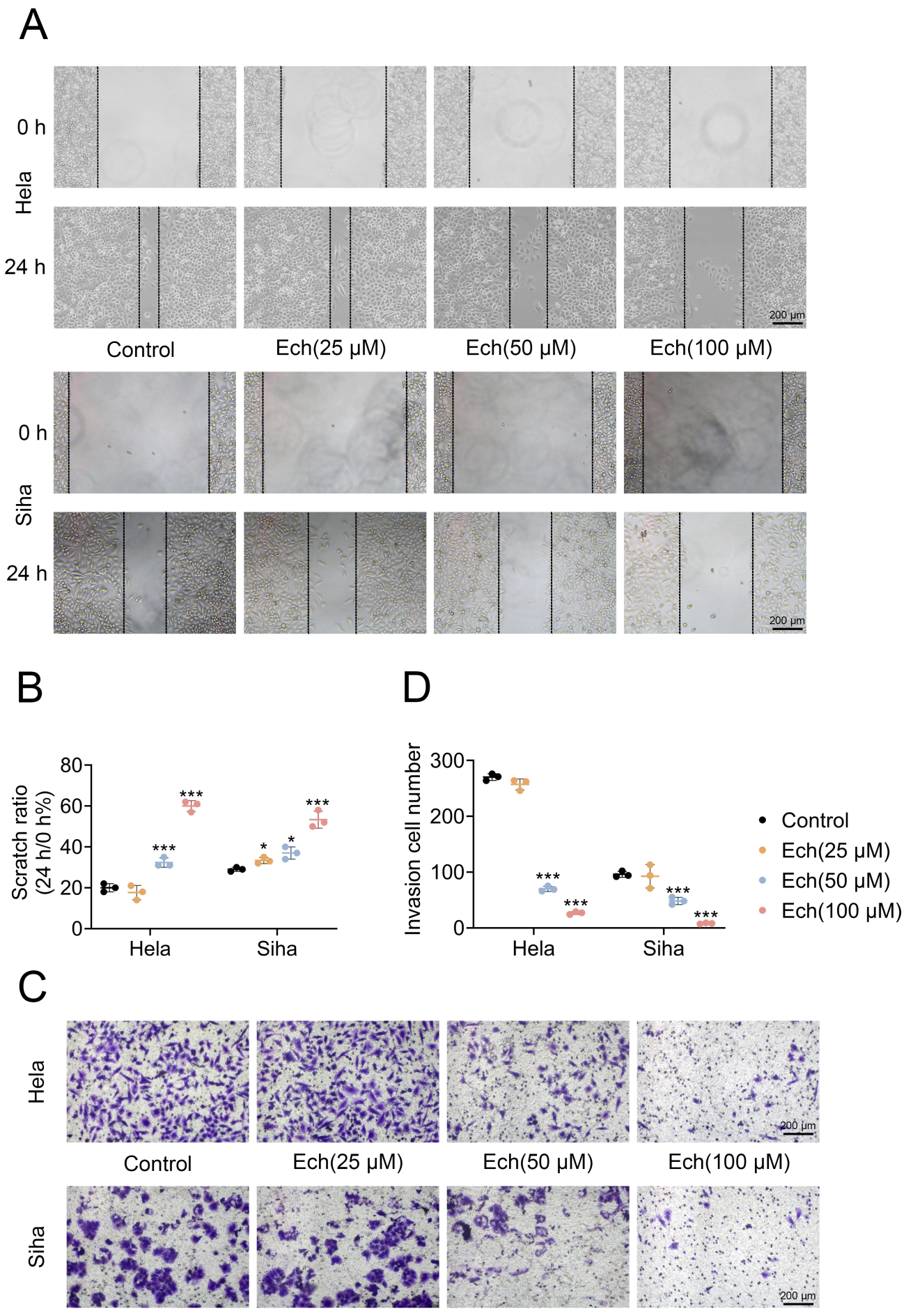 Echinacoside (Ech) inhibits the migration and invasion of 
cervical cancer cells. (A) Representative images of wound healing assays for 
Hela and Siha cells treated with 25 μM, 50 μM and 100 μM Ech at 
0 h and 24 h. (B) Quantifying the scratch ratio at 24 h shows a significant 
reduction in the migration of Hela and Siha cells treated with Ech. (C) 
Representative images of Transwell invasion assays for Hela and Siha cells 
treated with different concentrations of Ech (25 μM, 50 μM and 100 
μM). (D) Quantification of the invasion cell number. Data are presented as 
mean ± SD from three independent experiments (n = 3). Statistical 
significance was assessed using one-way ANOVA with Tukey’s post-hoc 
test. *p < 0.05, ***p < 0.001, 
vs. control.