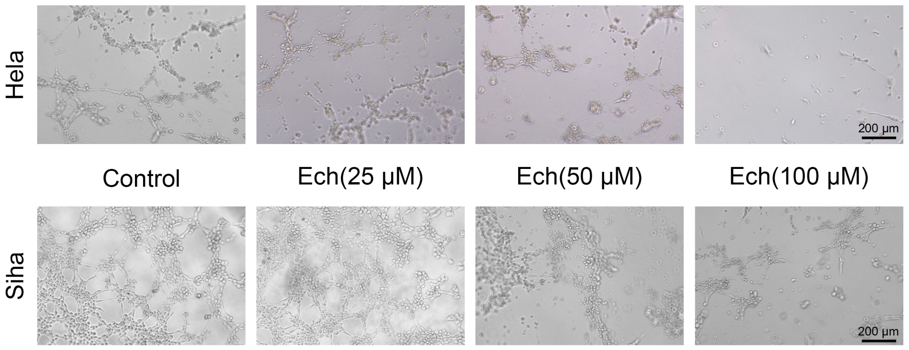 Echinacoside (Ech) inhibits the tube formation ability of 
cervical cancer cells. Representative images showing the effects of Ech (25 
μM, 50 μM and 100 μM) on tube formation by Hela and Siha cells. 
Control cells formed robust networks, while Ech treatment reduced the number and 
complexity of the tube-like structures in a dose-dependent manner. Data are 
presented as mean ± SD from three independent experiments (n = 3). 
Statistical significance was assessed using one-way ANOVA with Tukey’s 
post-hoc test.