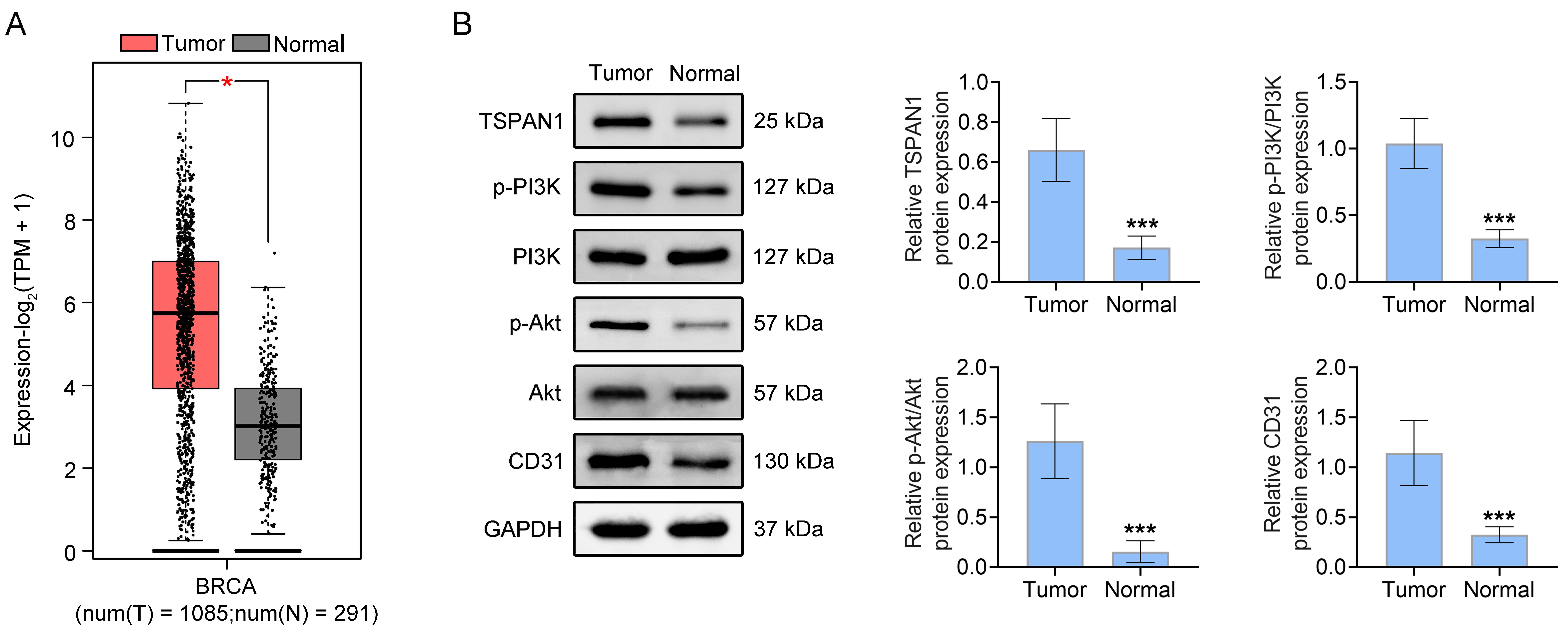 TSPAN1/PI3K/Akt signaling is upregulated in triple-negative
breast cancer. (A) GEPIA website analysis of the expression difference of TSPAN1
in breast cancer tissues and normal tissues. (B) Protein expression of TSPAN1,
PI3K, p-PI3K, Akt, p-Akt and CD31 in TNBC cancer tissue and adjacent tissue.
*: p < 0.05; ***: p < 0.001. n = 20.
PI3K: phosphoinositide 3-kinase; Akt: protein kinase B; TSPAN1: tetraspanin 1;
TPM: Transcripts Per Million; BRCA: Breast
invasive carcinoma; CD: Cluster of Differentiation; GAPDH:
Glyceraldehyde-3-phosphate dehydrogenase.