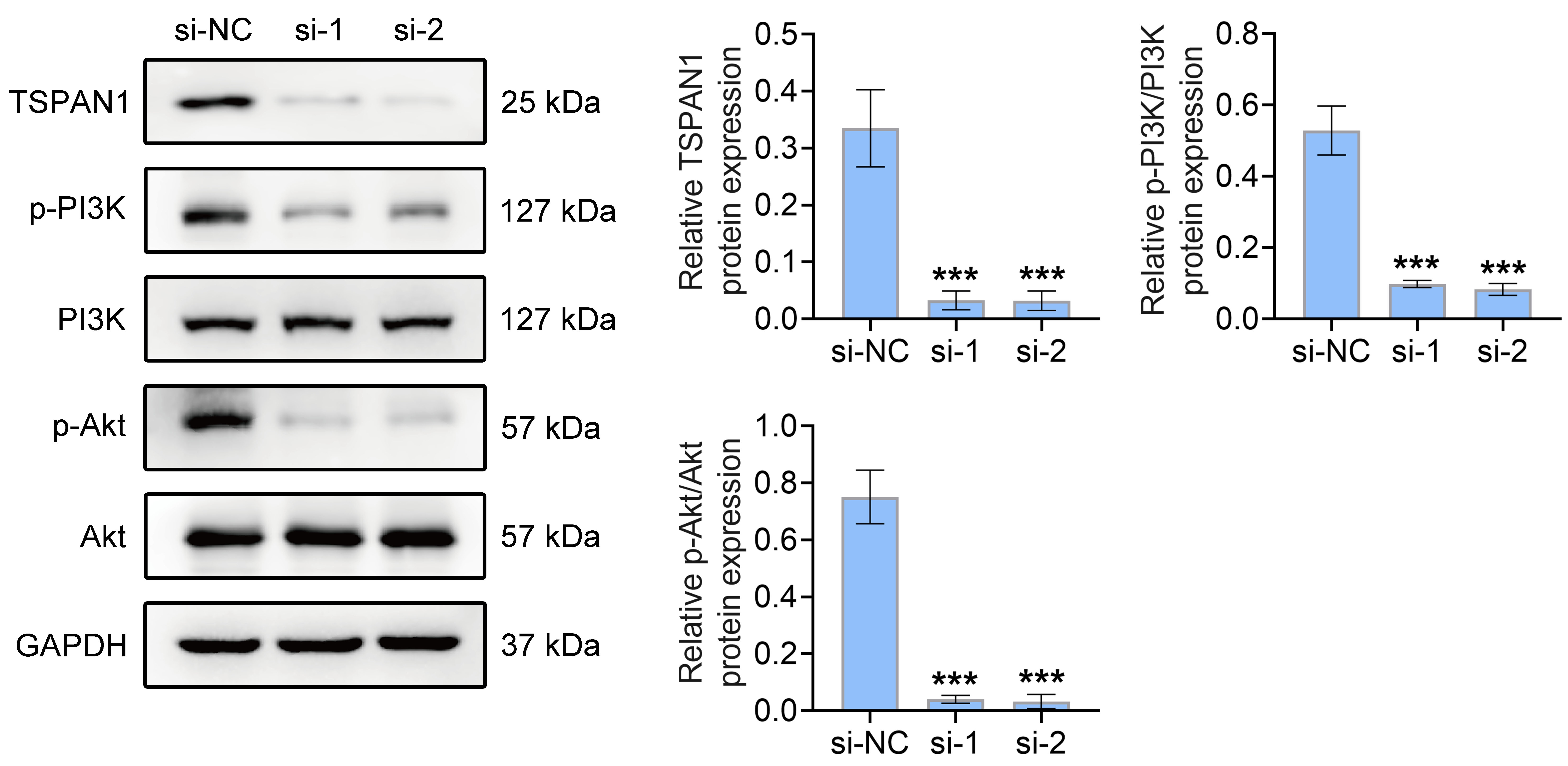 Knockdown of TSPAN1 inhibits the PI3K/Akt
pathway. Western blotting to detect the expression of TSPAN1, PI3K, p-PI3K, Akt,
p-Akt in TNBC Hs-578T cells. Values are presented as mean ± SD.
***p < 0.001 vs. si-NC group. n = 3. TSPAN:
tetraspanin; PI3K: phosphoinositide 3-kinase; Akt: protein kinase B; si-NC:
siRNA-transfected cells; GAPDH: Glyceraldehyde-3-phosphate dehydrogenase.