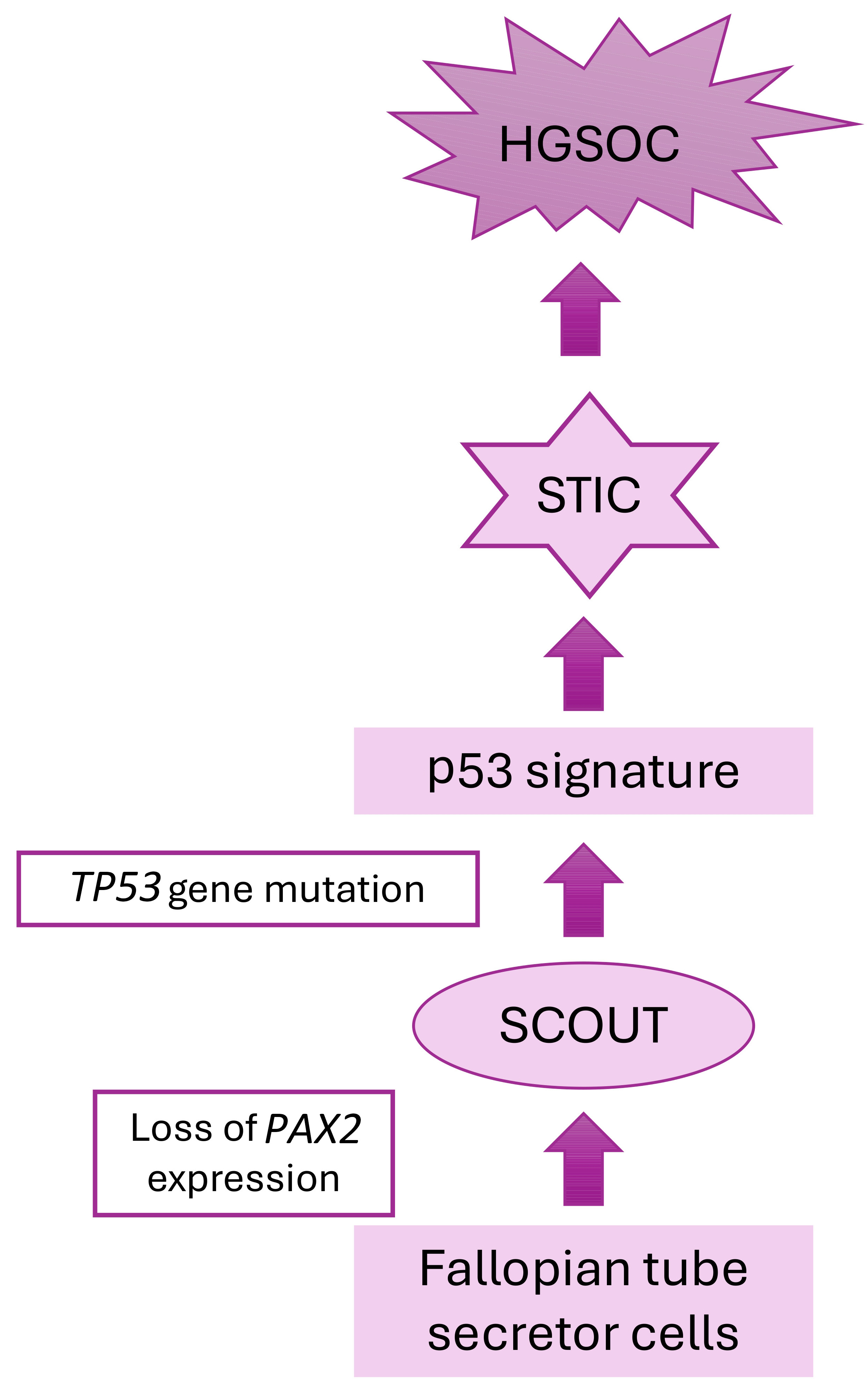 Sequence of oncogenesis in high grade ovarian serous carcinoma. 
HGSOC, high-grade serous ovarian carcinoma; SCOUT, secretory cell outgrowths; 
STIC, serous tubal intraepithelial carcinoma; TP53, tumour protein p53 
gene; PAX2, paired box gene 2. Figure created by the authors.
