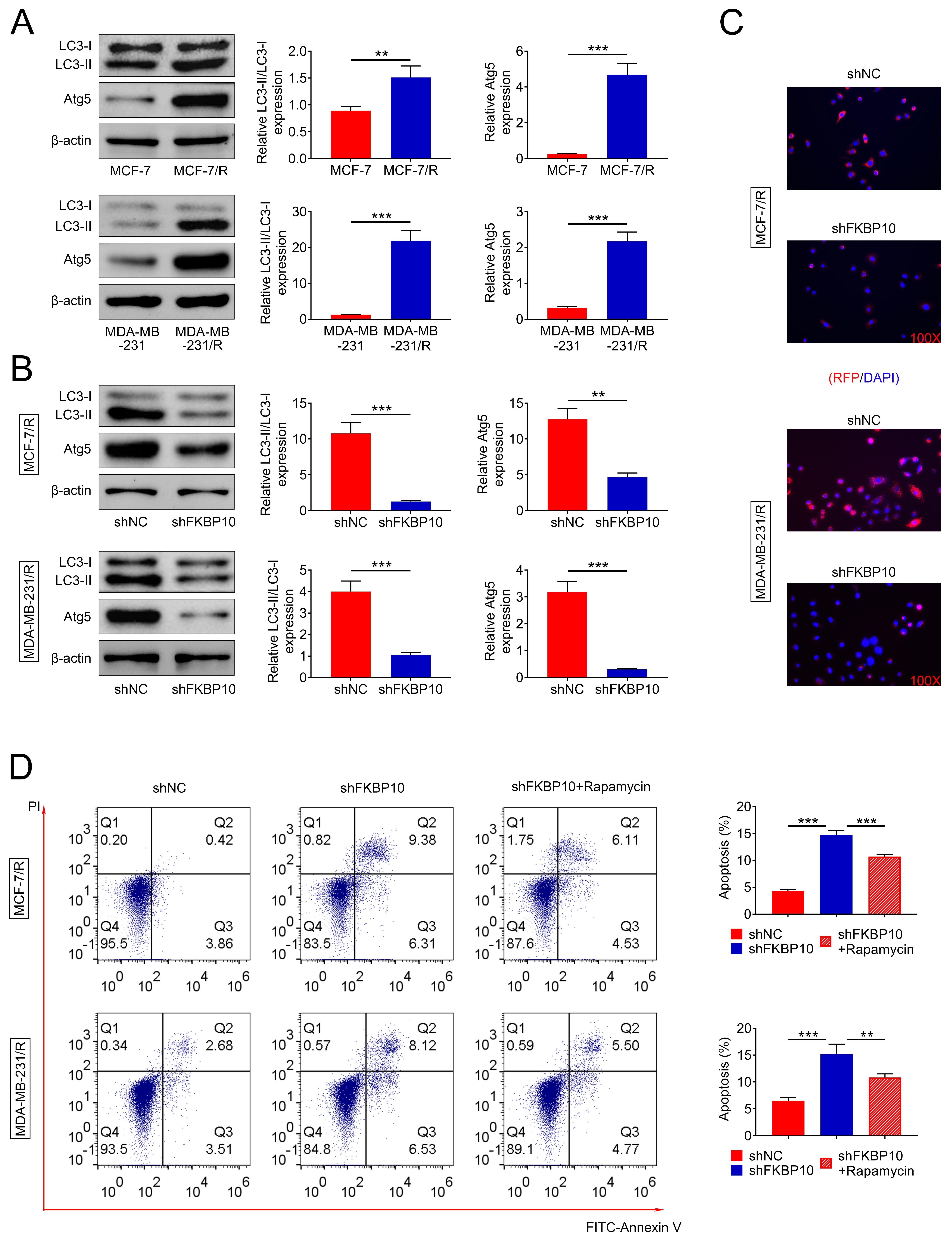 Depletion of FKBP10 suppressed autophagy in PTX-resistant breast 
cancer cells. (A) Immunoblot analysis of LC3II, LC3I, and ATG5 expression in 
PTX-resistant and non-resistant MCF-7 and MDA-MB-231 cells. (B) Immunoblot 
analysis of LC3II, LC3I, and ATG5 expression in PTX-resistant MCF-7 and 
MDA-MB-231 cells under the indicated treatments. (C) RFP-LC3 fluorescence 
intensity in MDA-MB-231 cells under the indicated treatments. (D) Flow cytometry 
analysis of apoptosis rates in MDA-MB-231 cells under the indicated treatments. 
Each experiment was repeated three times. Data are shown as mean ± SD, 
**p < 0.01, ***p < 0.001. FKBP10: FK506 
Binding Protein 10; LC3: microtubule-associated protein 1 light chain 3; ATG5: 
autophagy related 5; shNC: short hairpin negative control; RFP: red fluorescent 
protein; DAPI: 4′,6-diamidino-2-phenylindole; PI: propidium iodide; FITC: 
fluorescein isothiocyanate.