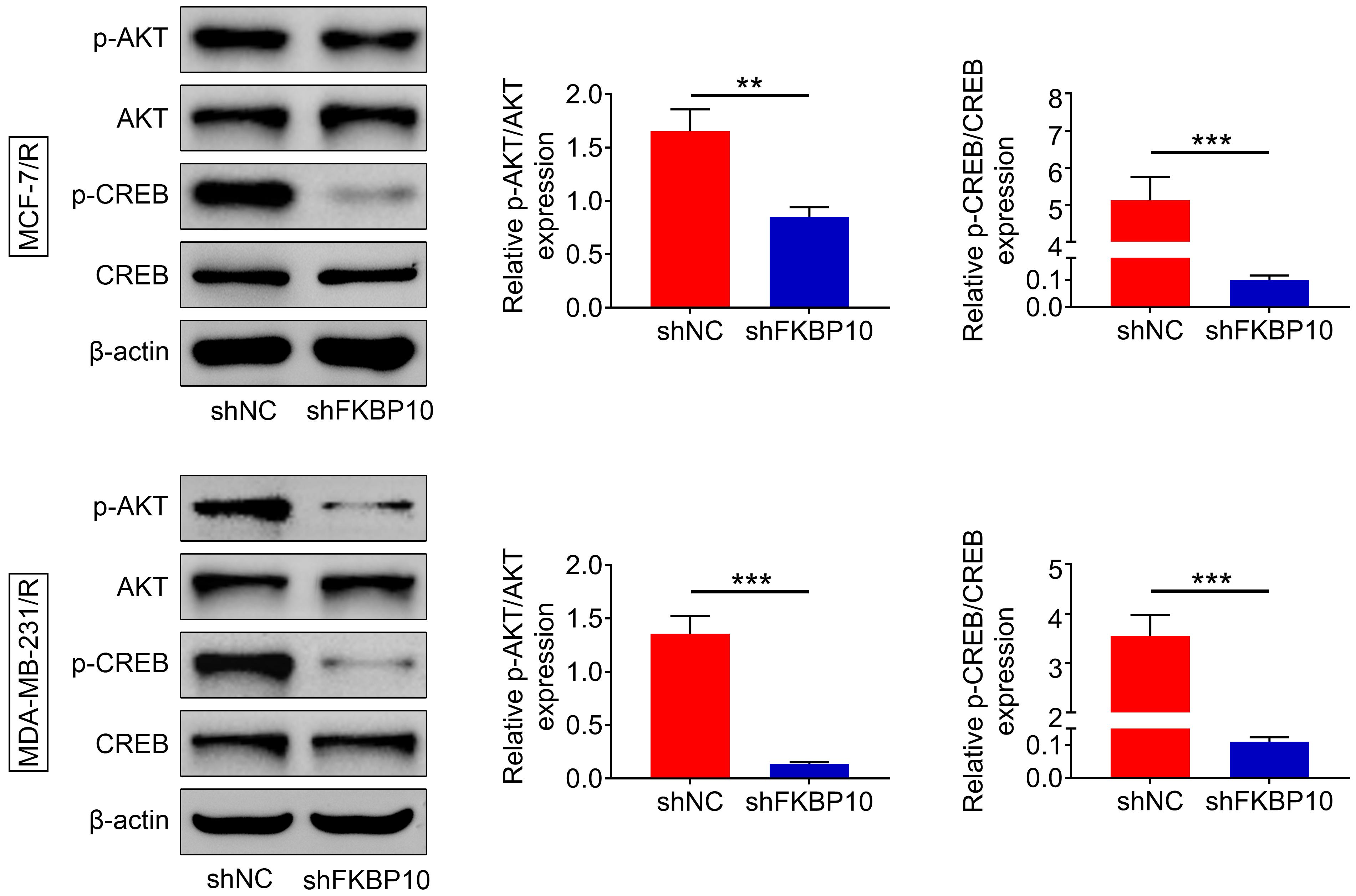 FKBP10 mediated the AKT/CREB axis in PTX-resistant breast cancer 
cells. Immunoblot analysis of AKT, CREB, and their phosphorylated forms (p-AKT 
and p-CREB) in PTX-resistant MCF-7 and MDA-MB-231 cells under the indicated 
treatments. Each experiment was repeated three times. Data are shown as mean 
± SD, **p < 0.01, ***p < 0.001. 
FKBP10: FK506 Binding Protein 10; AKT: protein kinase B; CREB: cAMP response 
element-binding protein; shNC: short hairpin negative control.