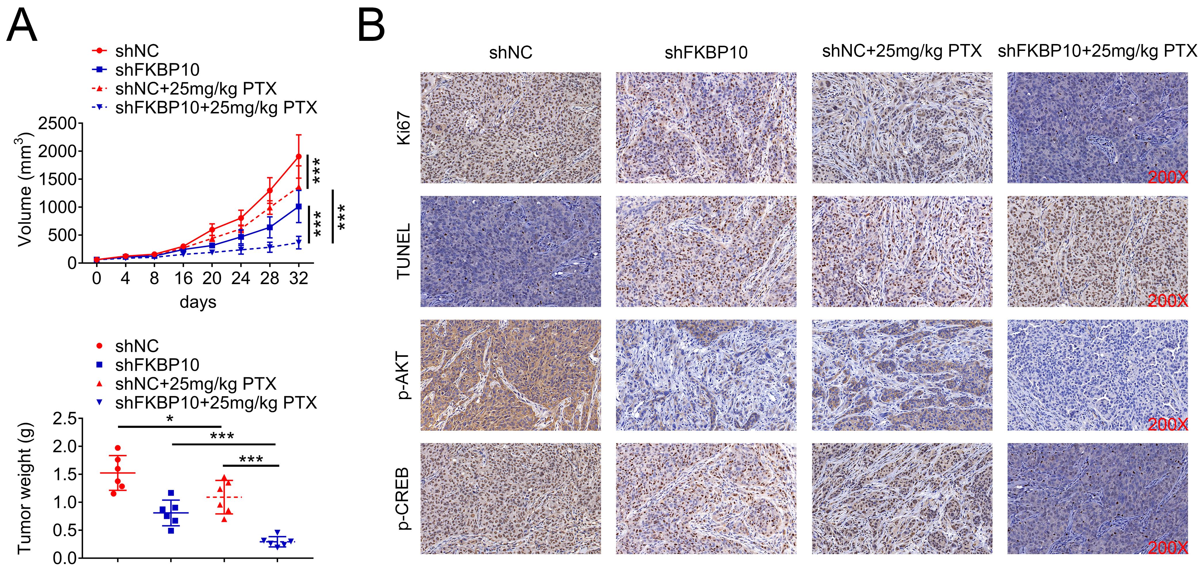 FKBP10 knockdown inhibited tumor growth and increased PTX 
sensitivity in vivo. (A) Xenograft assays showing differences in tumor 
growth and tumor weight among the indicated groups. (B) IHC staining of Ki67, 
TUNEL, p-AKT, and p-CREB in tumor tissues from the indicated groups. Each 
experiment was repeated three times. Data are shown as mean ± SEM, 
*p < 0.05, ***p < 0.001. FKBP10: FK506 
Binding Protein 10; PTX: paclitaxel; shNC: short hairpin negative control; TUNEL: 
terminal deoxynucleotidyl transferase dUTP nick end labeling; AKT: protein kinase 
B; CREB: cAMP response element-binding protein.
