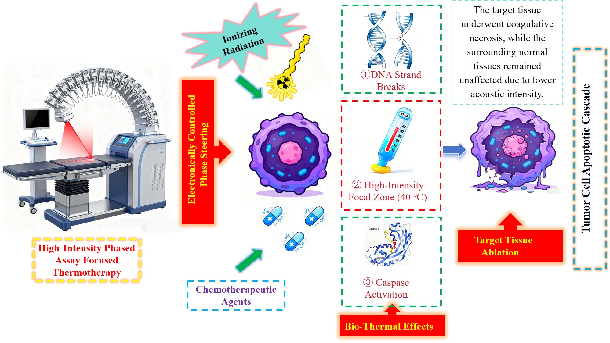 Schematic diagram illustrating the mechanism of action of
high-intensity focused hyperthermia in the pelvic region.