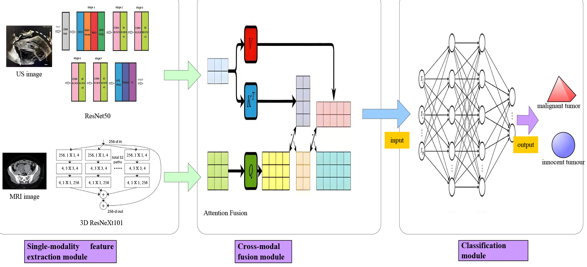 Schematic diagram of the deep learning multimodal fusion model 
architecture. US: ultrasound; MRI: magnetic resonance imaging; 
ZERO PAD: Zero Padding; CONV: Convolutional Layer; Batch Norm: 
Batch Normalization; ReLU: Rectified Linear Unit; MAX POOL: Max Pooling Layer; 
ID: Identity; AVG POOL: Global Average Pooling; FC: Fully Connected Layer; 
ResNet50: Residual Network with 50 layers. *: Sigmoid activation function.