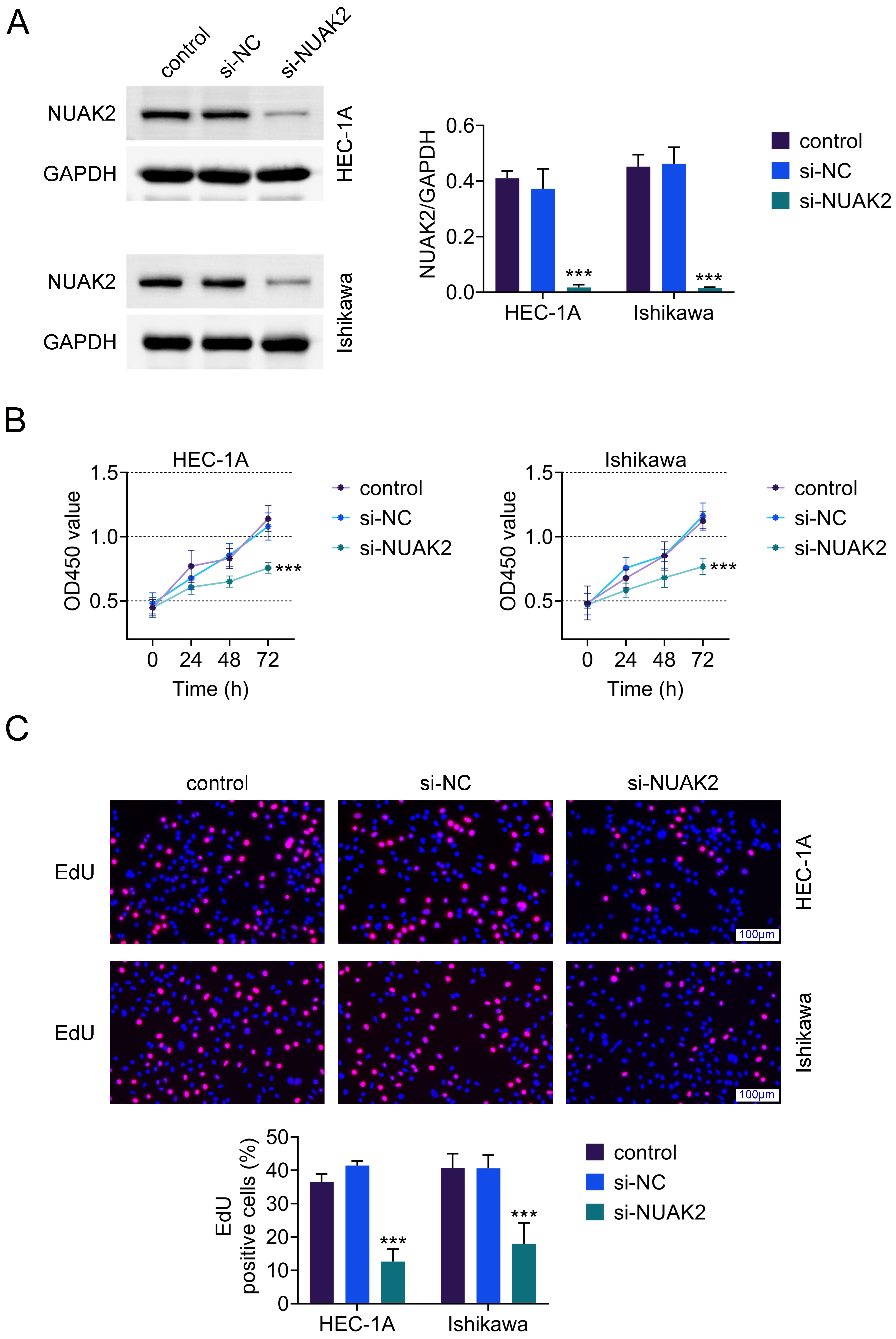 Knockdown of NUAK2 inhibits the growth of endometrial cancer 
cells. (A) Western blotting analysis of NUAK2 expression. (B) 
CCK-8 assay for cell viability. (C) EdU staining for cell proliferation. Blue 
staining represents the nuclei of all cells, and pink staining represents 
proliferating cells undergoing DNA replication. Values are presented as mean 
± SD. ***p  < 0.001 vs. si-NC group. n = 3. 
NUAK2: NUAK family kinase 2; GAPDH: Glyceraldehyde-3-Phosphate Dehydrogenase; 
EdU: 5-ethynyl-2′-deoxyuridine; OD: Optical Density; si-NC: small interfering 
RNA negative control; HEC-1A: human endometrial cancer cell lines.